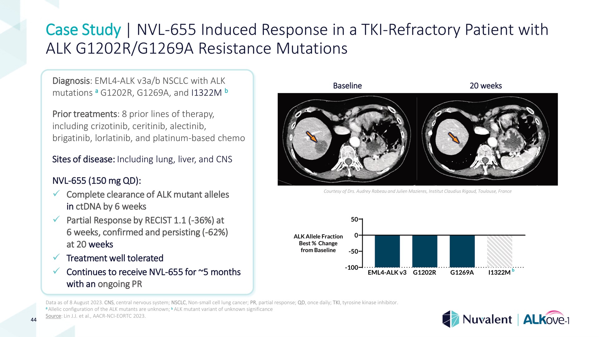 case study induced response in a refractory patient with alk a resistance mutations refractory | Nuvalent