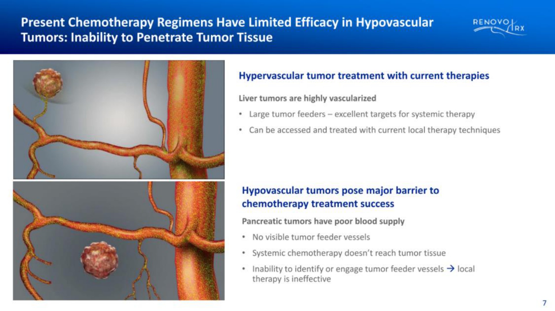 present chemotherapy regimens have limited efficacy in tumors inability to penetrate tumor tissue | RenovoRx
