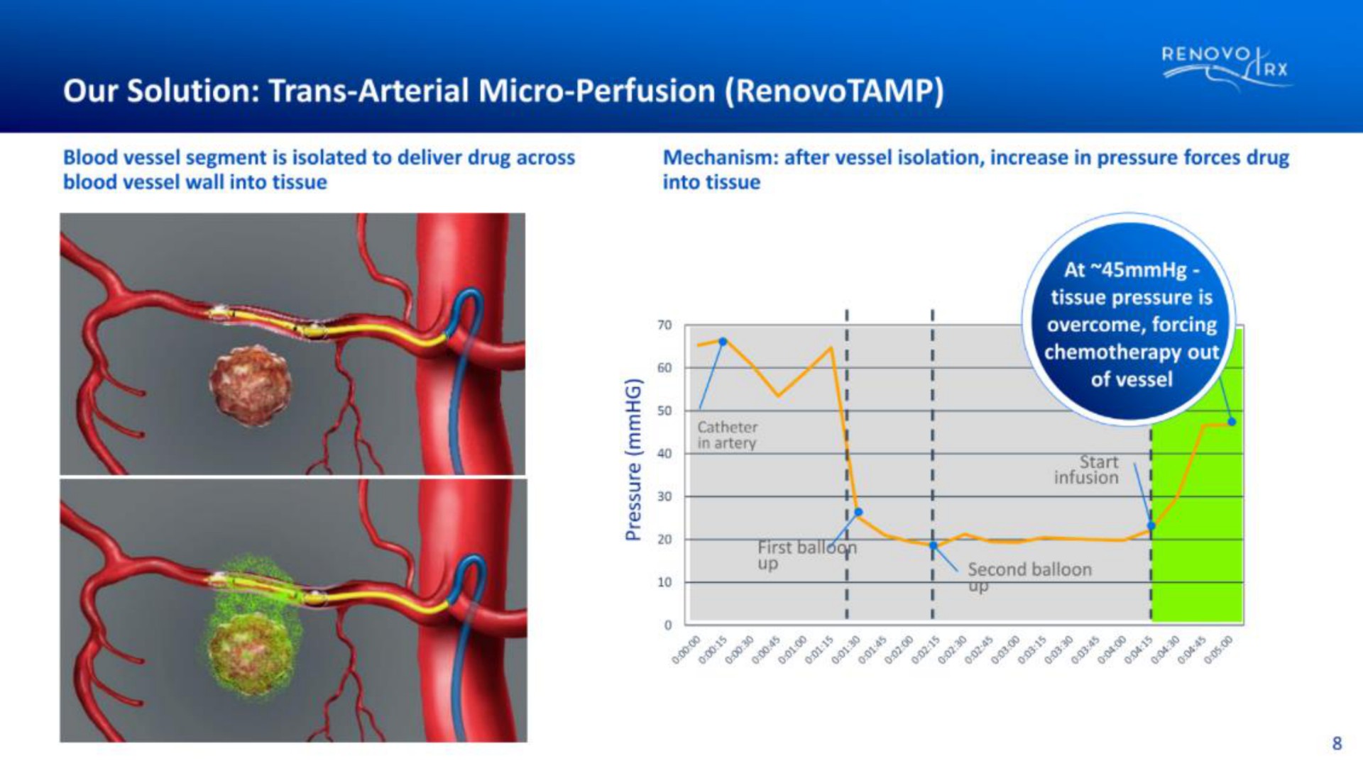 our solution arterial micro perfusion | RenovoRx