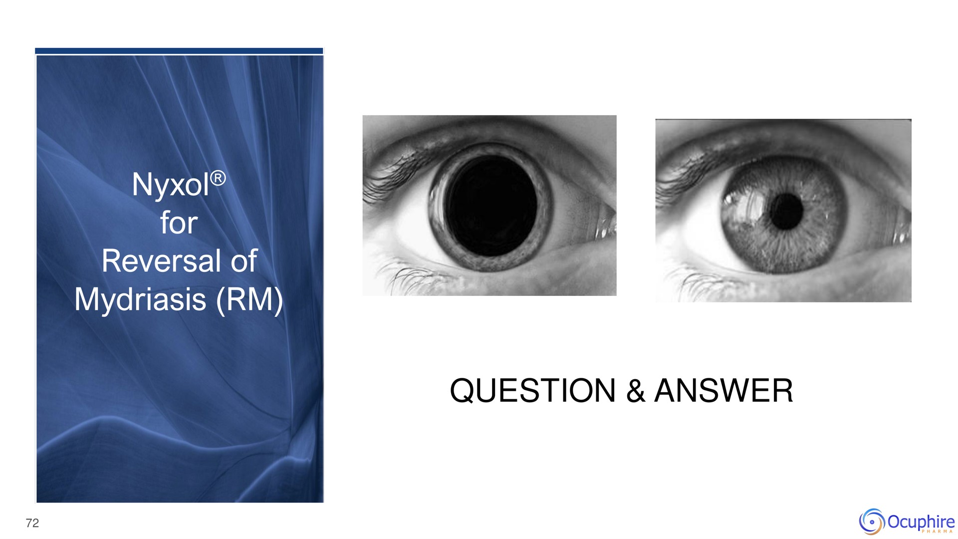 for reversal of mydriasis question answer axe | Ocuphire Pharma