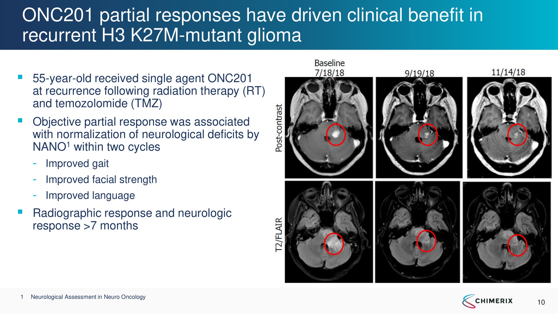 partial responses have driven clinical benefit in recurrent mutant glioma | Chimerix