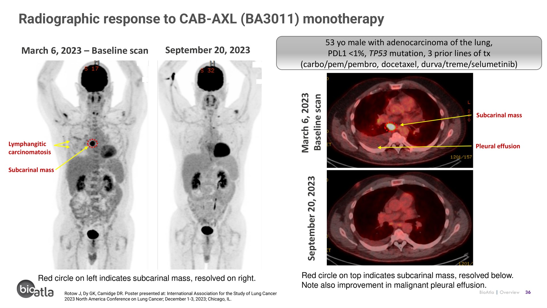 radiographic response to cab | BioAtla