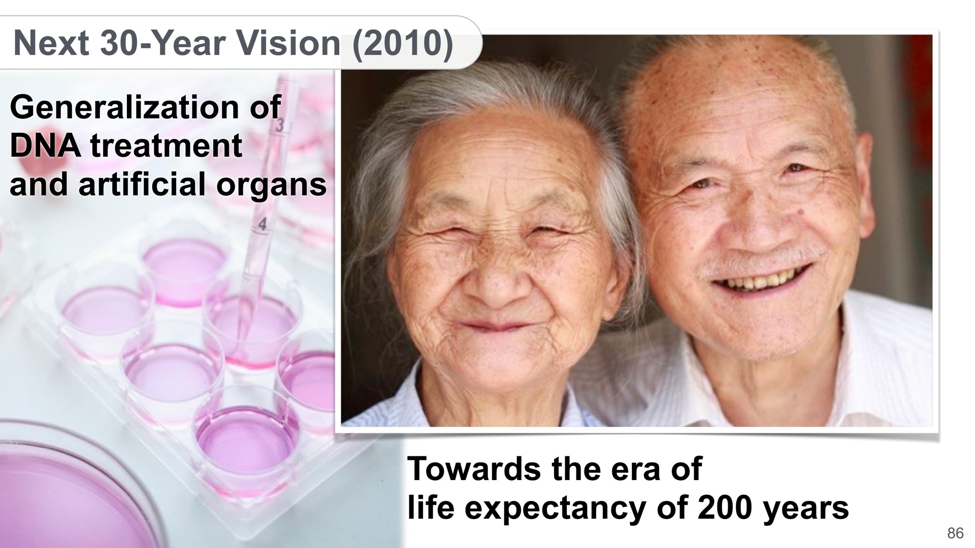 next year vision generalization of and artificial organs towards the era of life expectancy of years | SoftBank