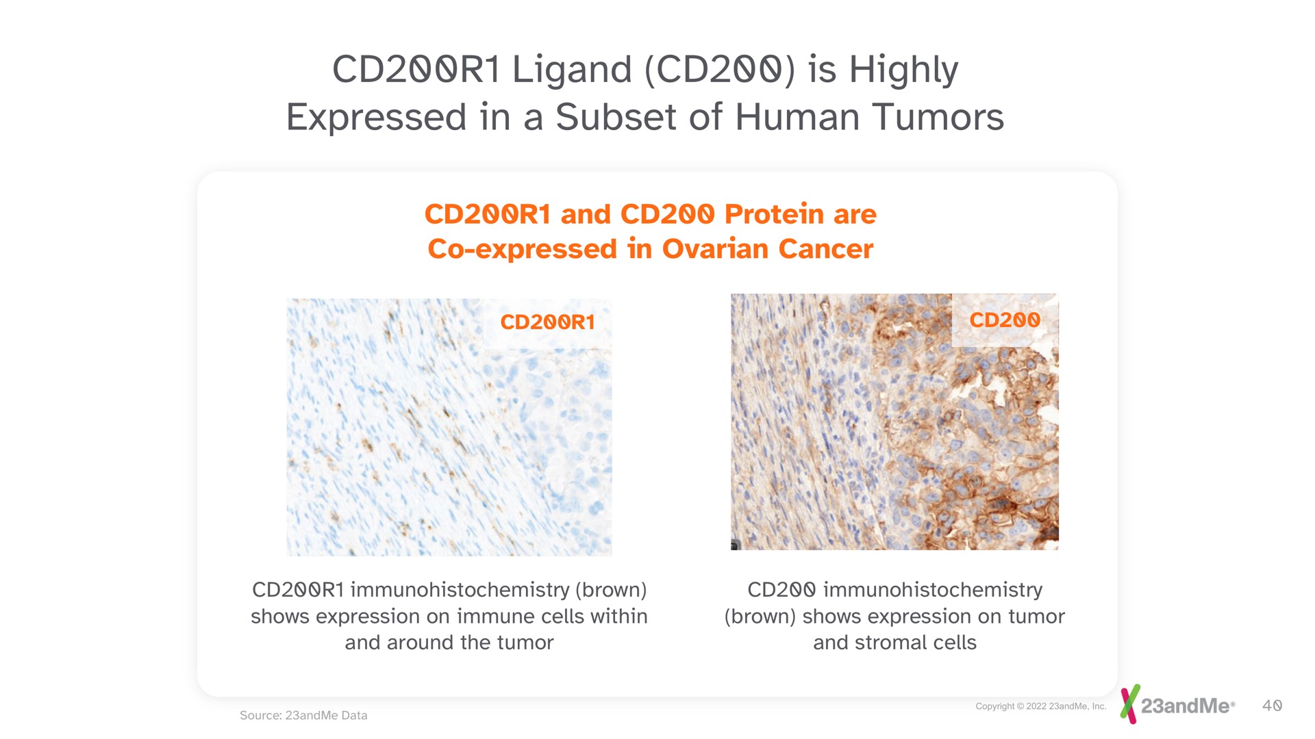 is highly expressed in a subset of human tumors | 23andMe