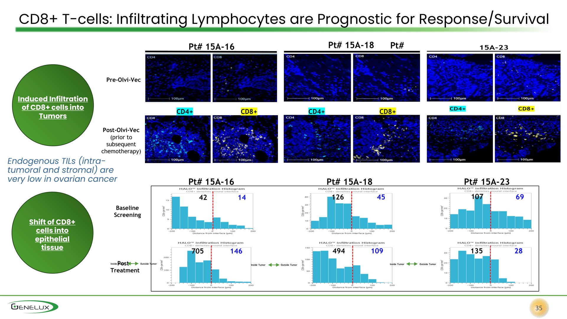 cells infiltrating lymphocytes are prognostic for response survival | Genelux