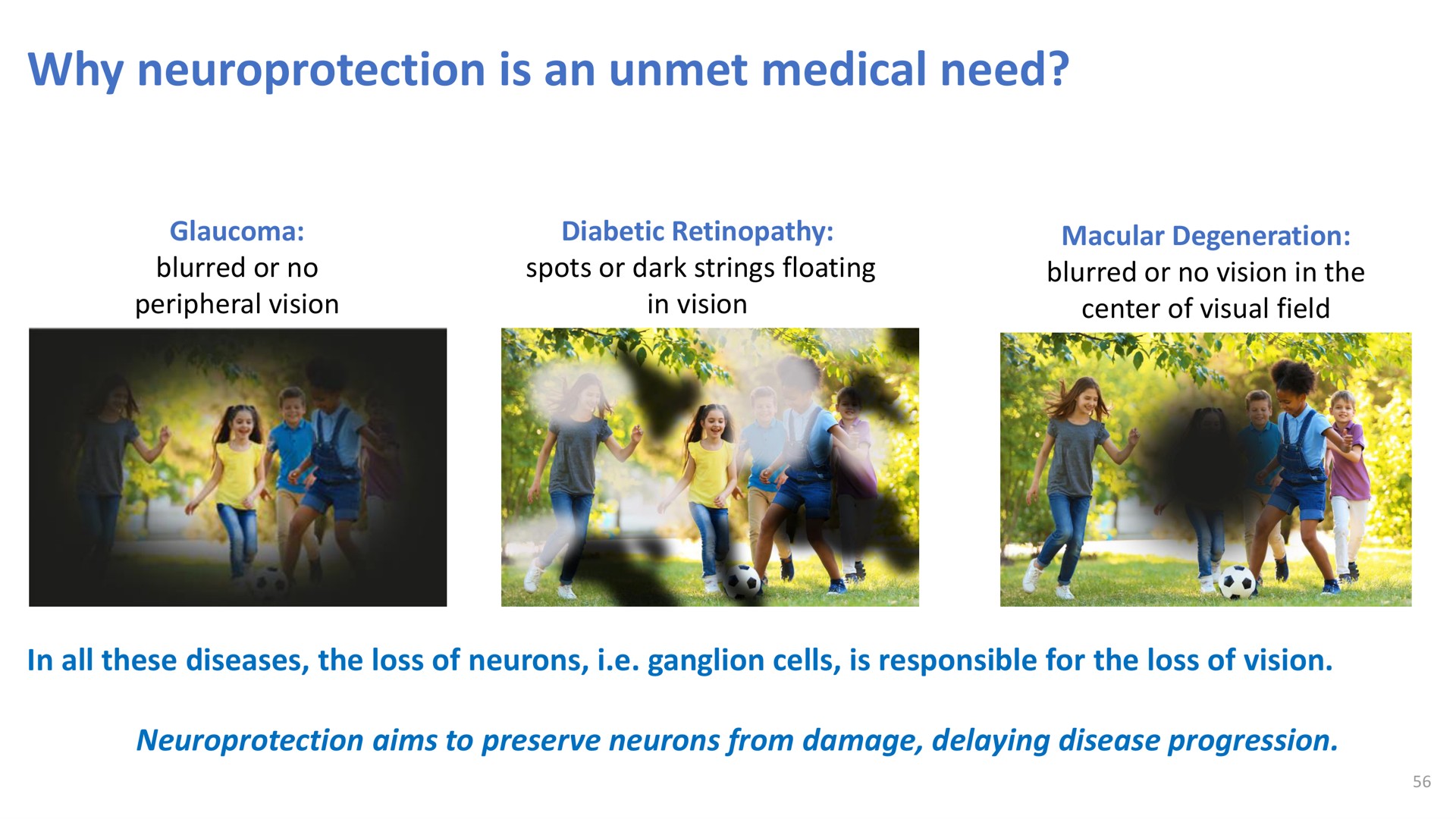 why is an unmet medical need | Oculis