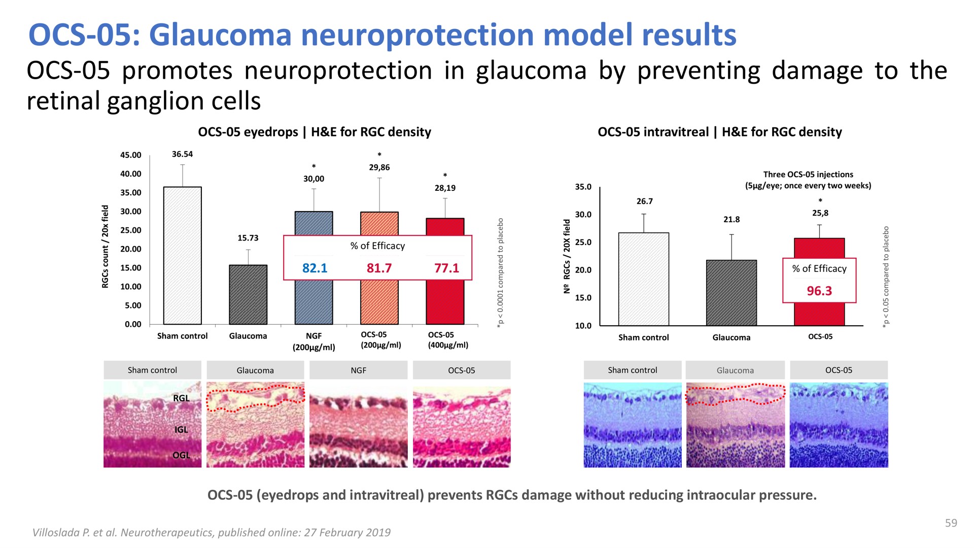 glaucoma model results promotes in glaucoma by preventing damage to the retinal ganglion cells | Oculis