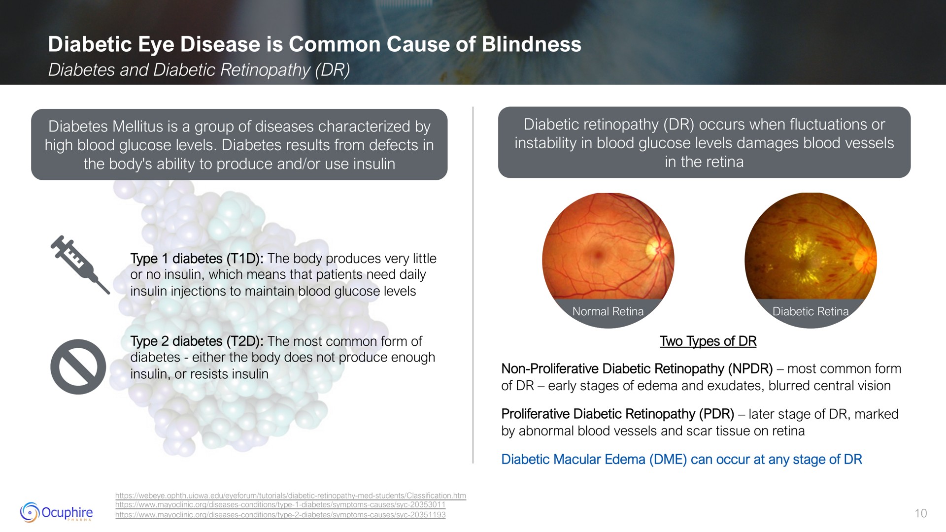 diabetic eye disease is common cause of blindness | Ocuphire Pharma