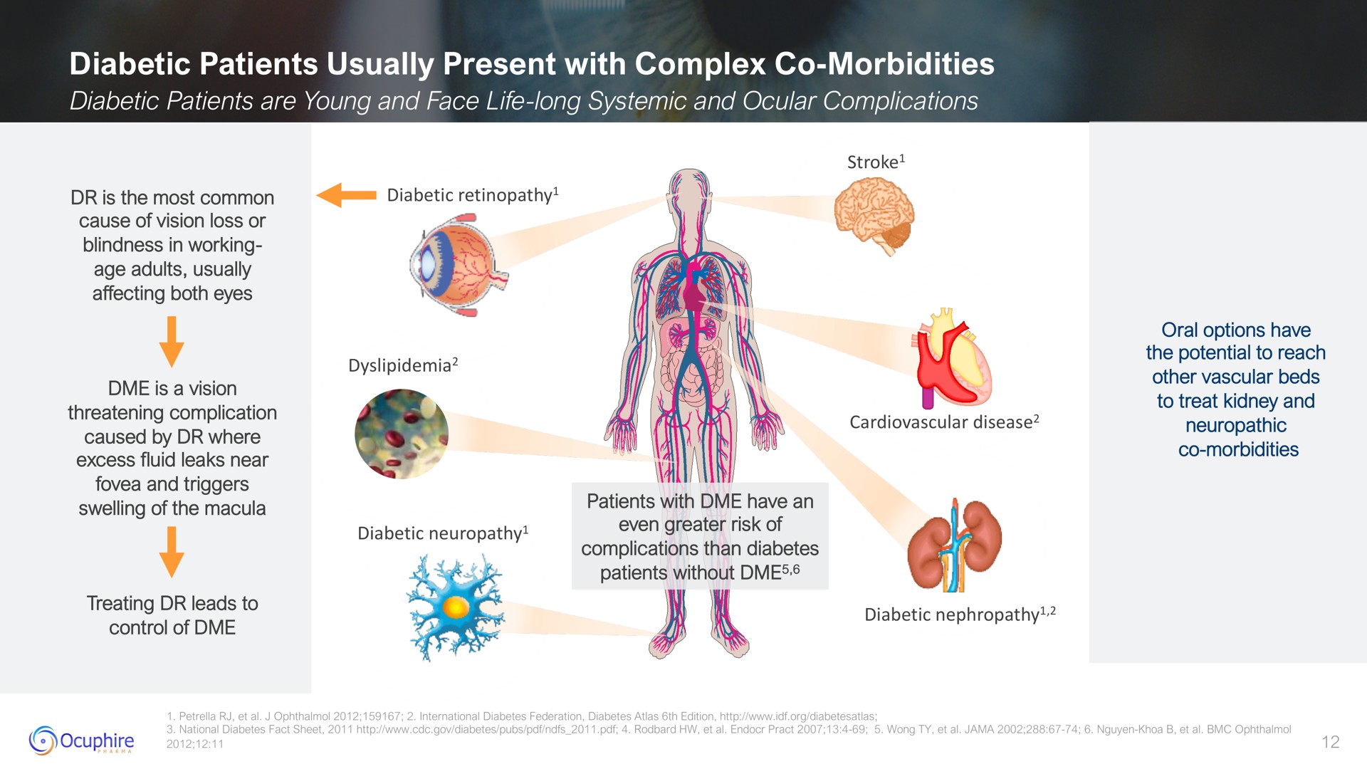 diabetic patients usually present with complex morbidities | Ocuphire Pharma