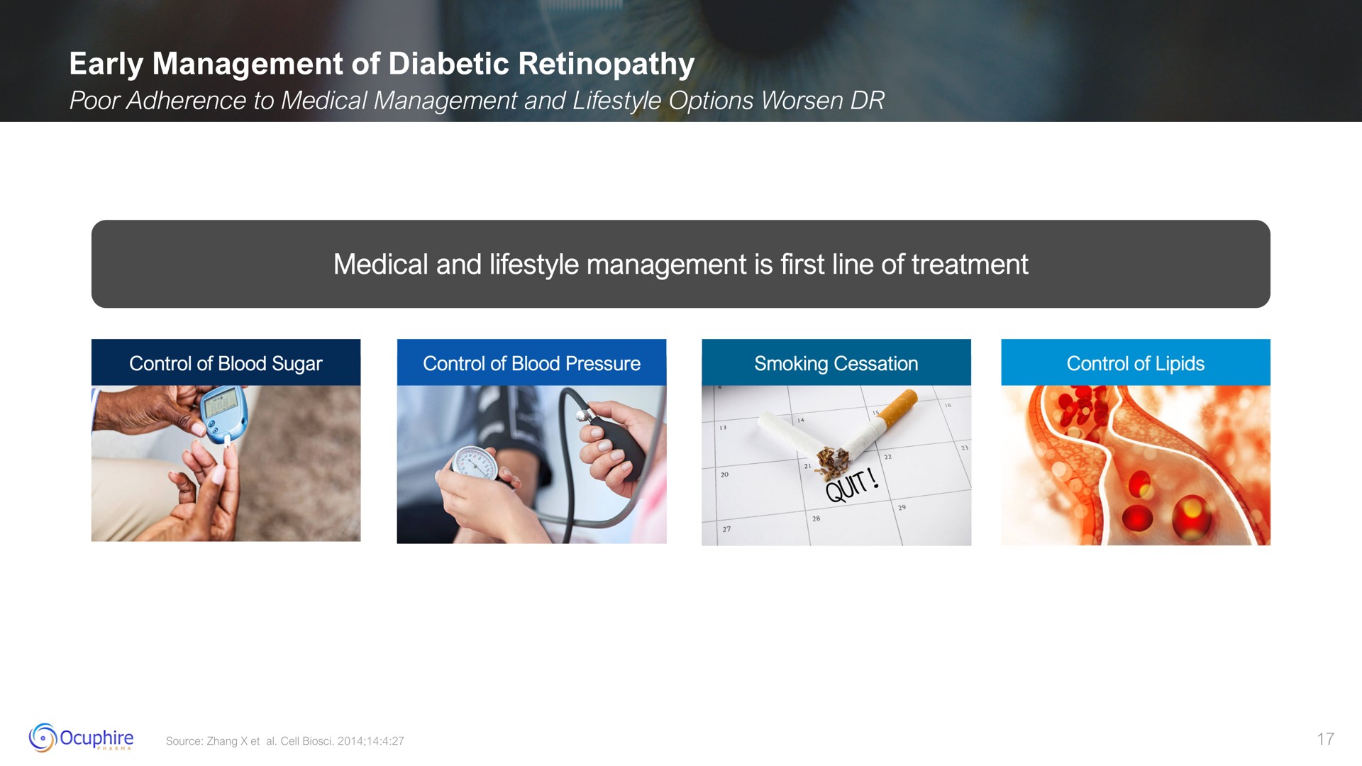 early management of diabetic medical and management is first line of treatment | Ocuphire Pharma