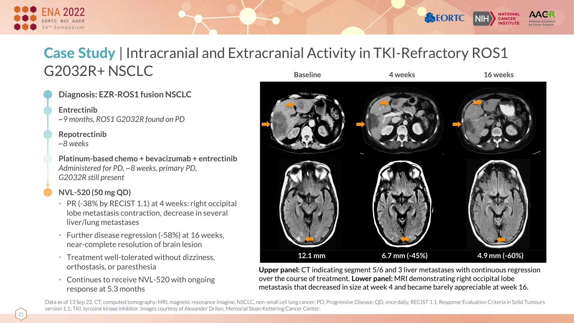 case study intracranial and extracranial activity in refractory bet | Nuvalent