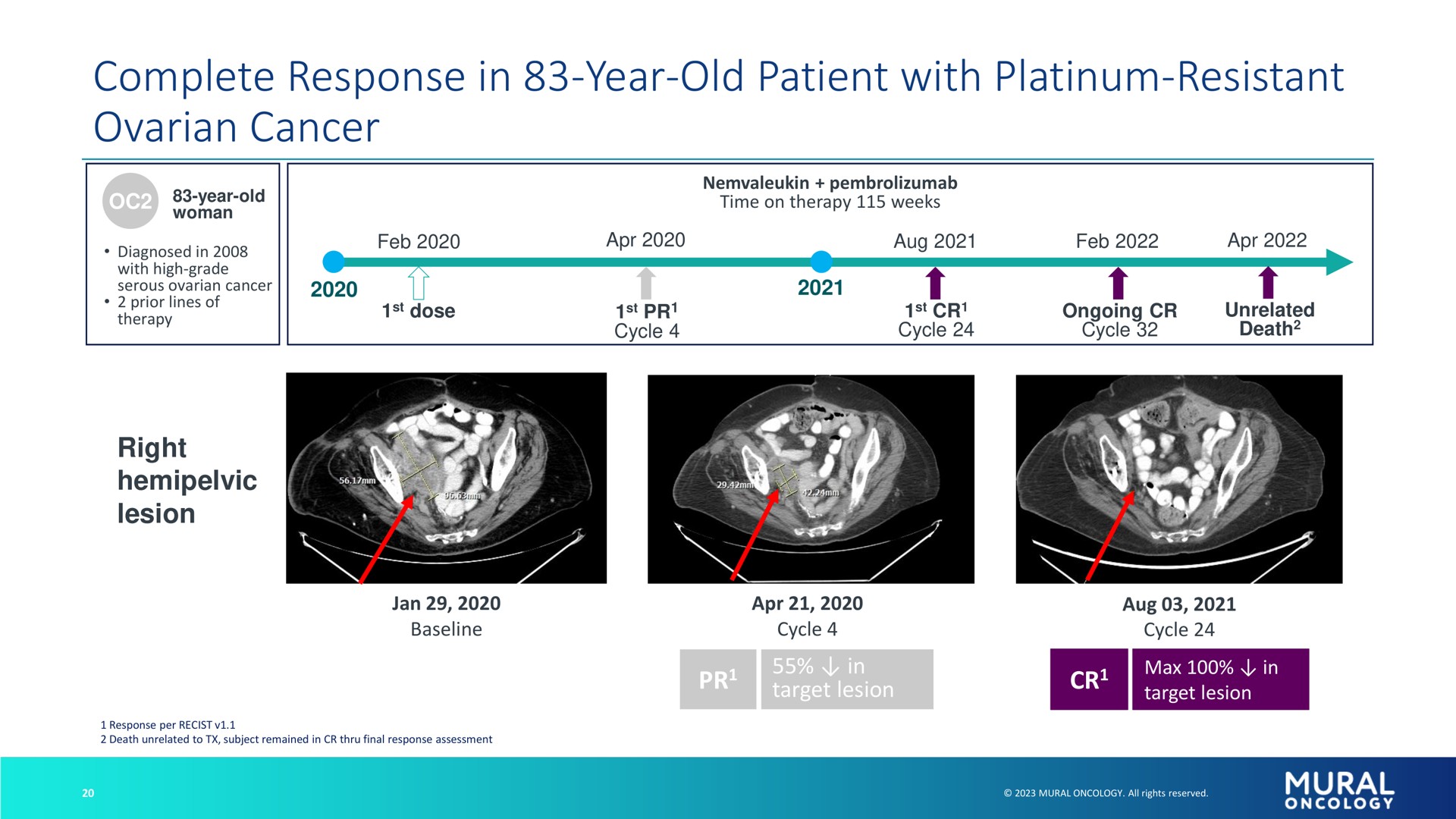 complete response in year old patient with platinum resistant ovarian cancer | Alkermes
