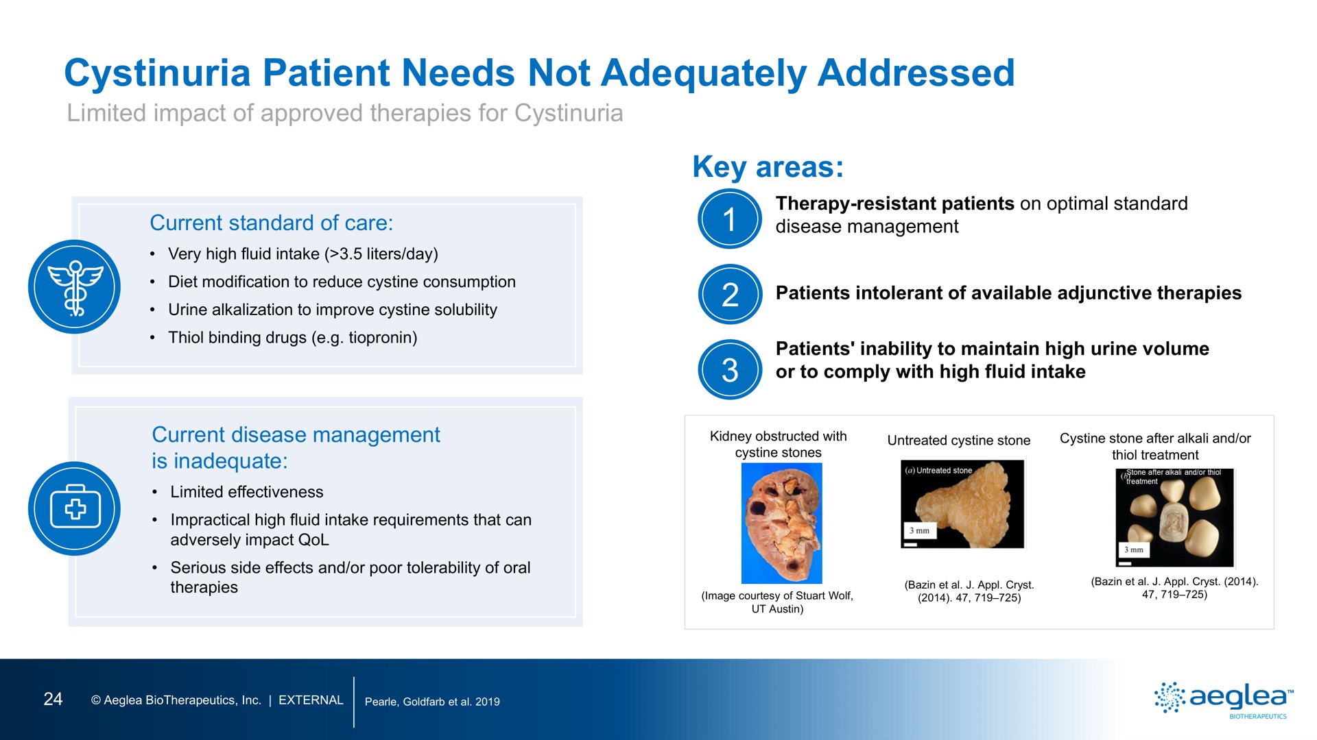 cystinuria patient needs not adequately addressed | Aeglea BioTherapeutics