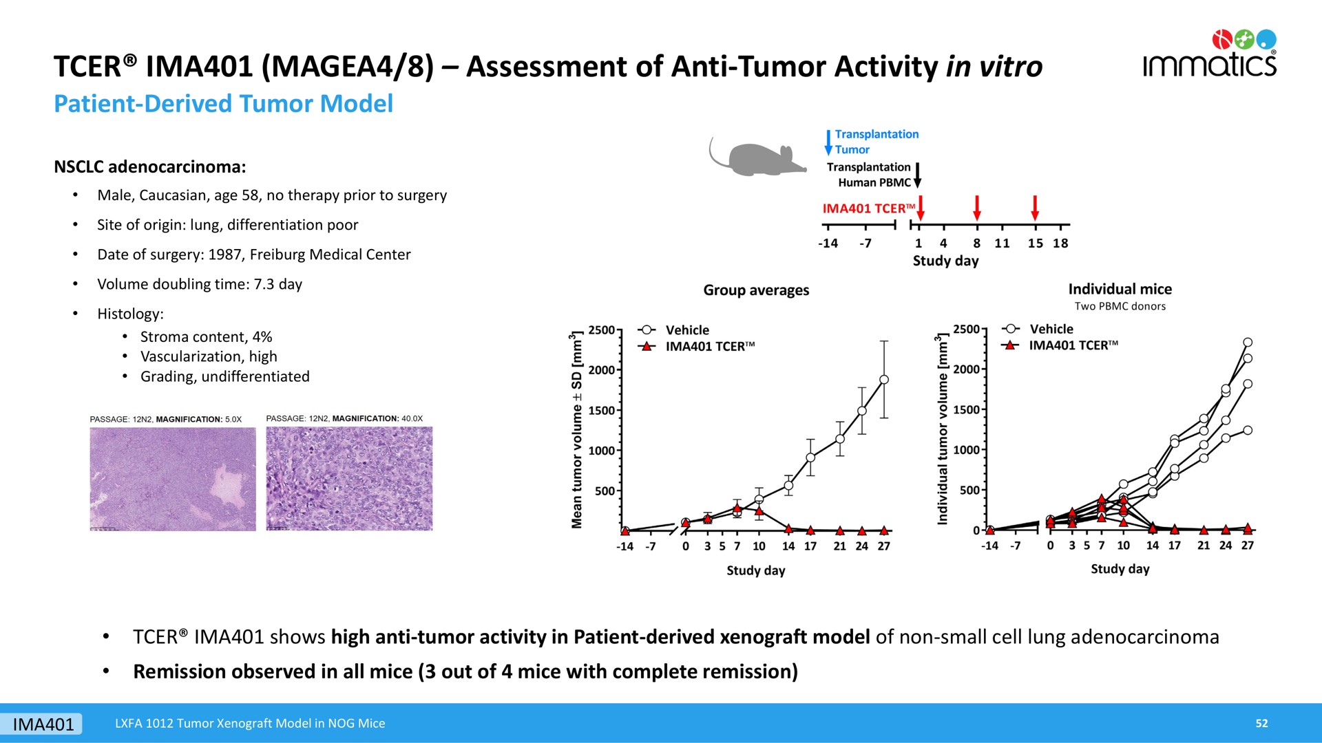 assessment of anti tumor activity in | Immatics