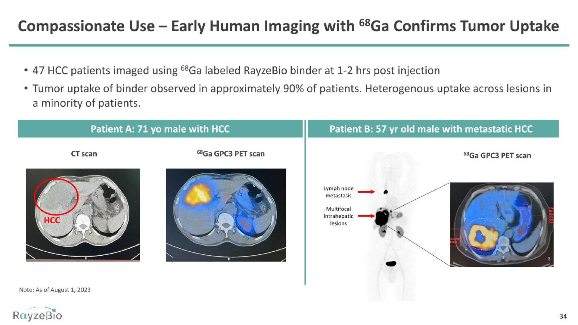 compassionate use early human imaging with confirms tumor uptake | RayzeBio