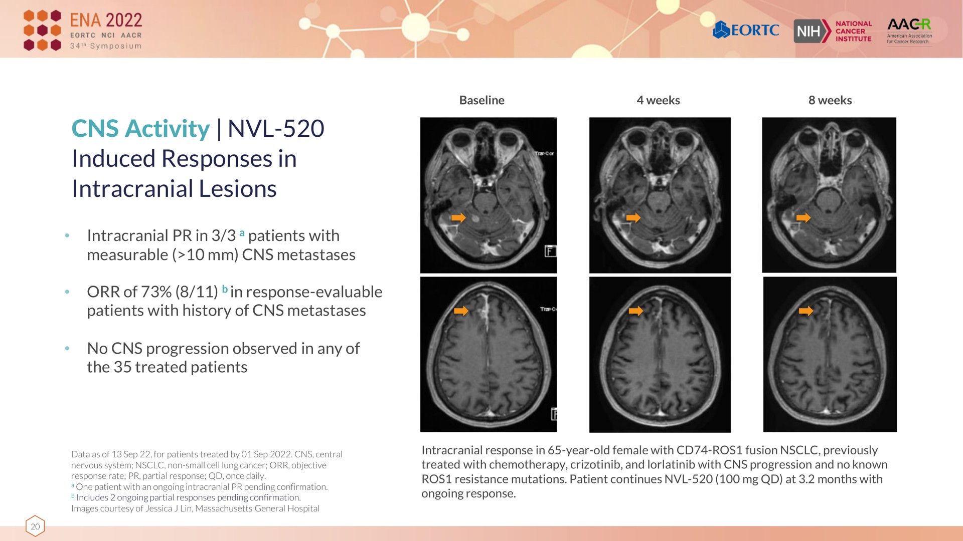 activity induced responses in intracranial lesions | Nuvalent