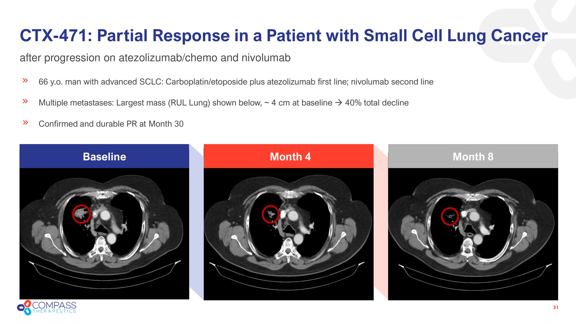 partial response in a patient with small cell lung cancer i | Compass Therapeutics