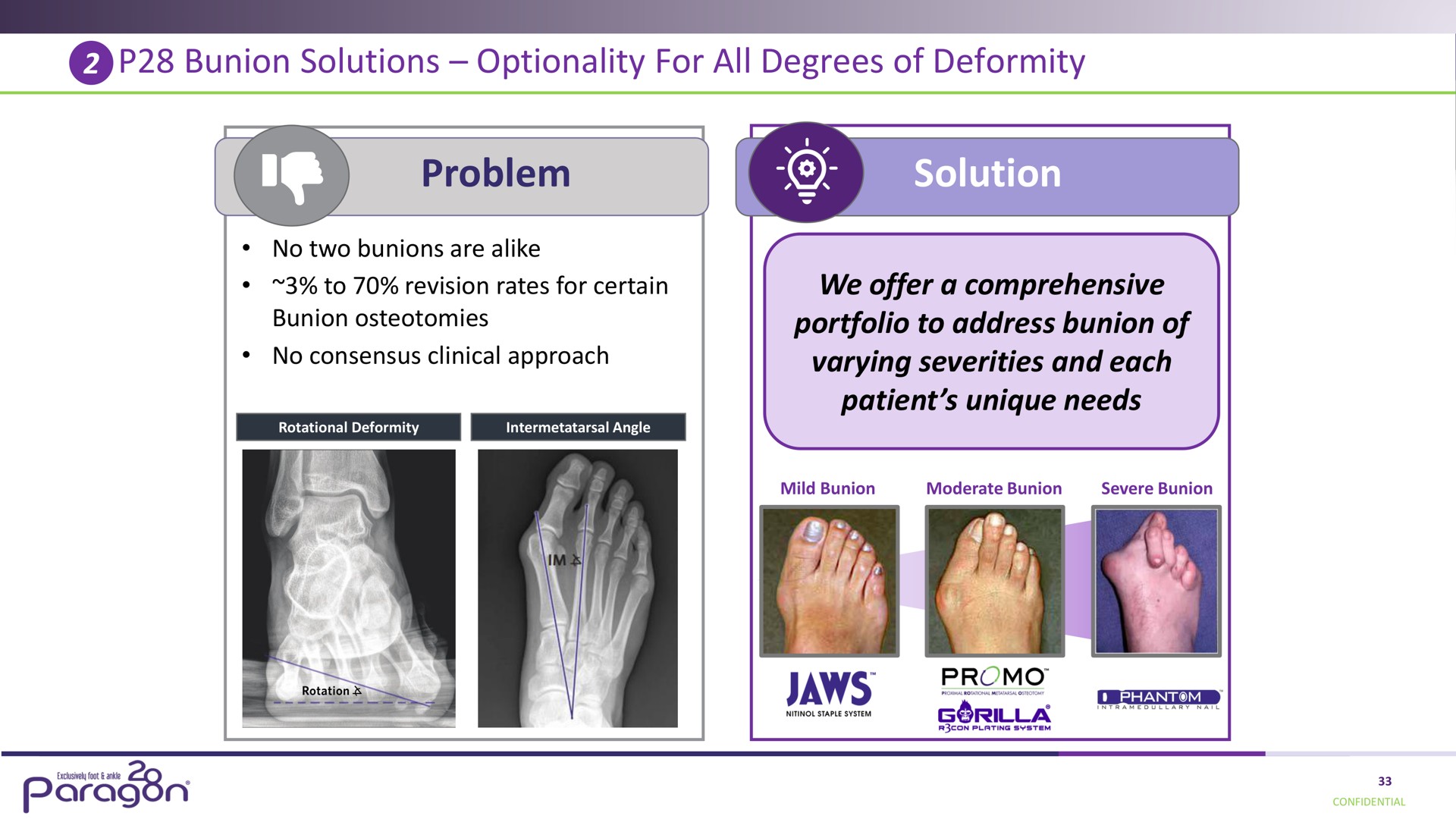 bunion solutions optionality for all degrees of deformity problem solution a | Paragon28
