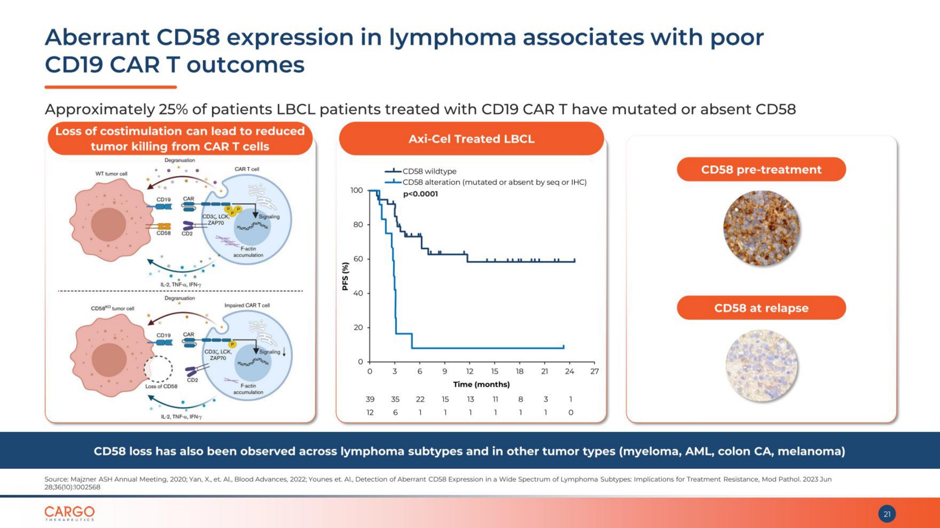 aberrant expression in lymphoma associates with poor car outcomes | CARGO Therapeutics
