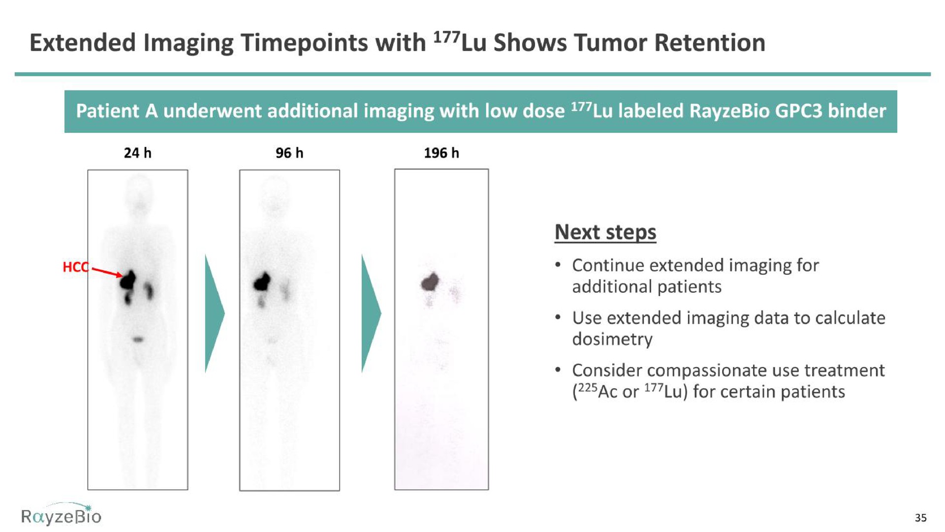 extended imaging with shows tumor retention | RayzeBio