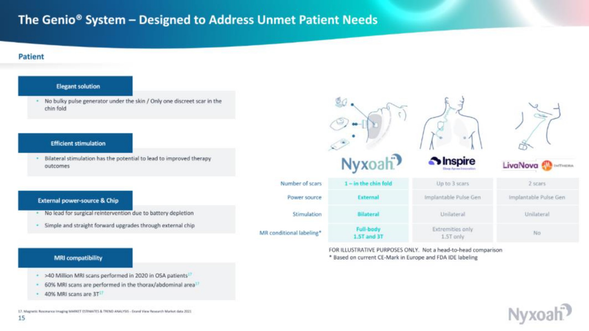 the system designed to address unmet patient needs a | Nyxoah