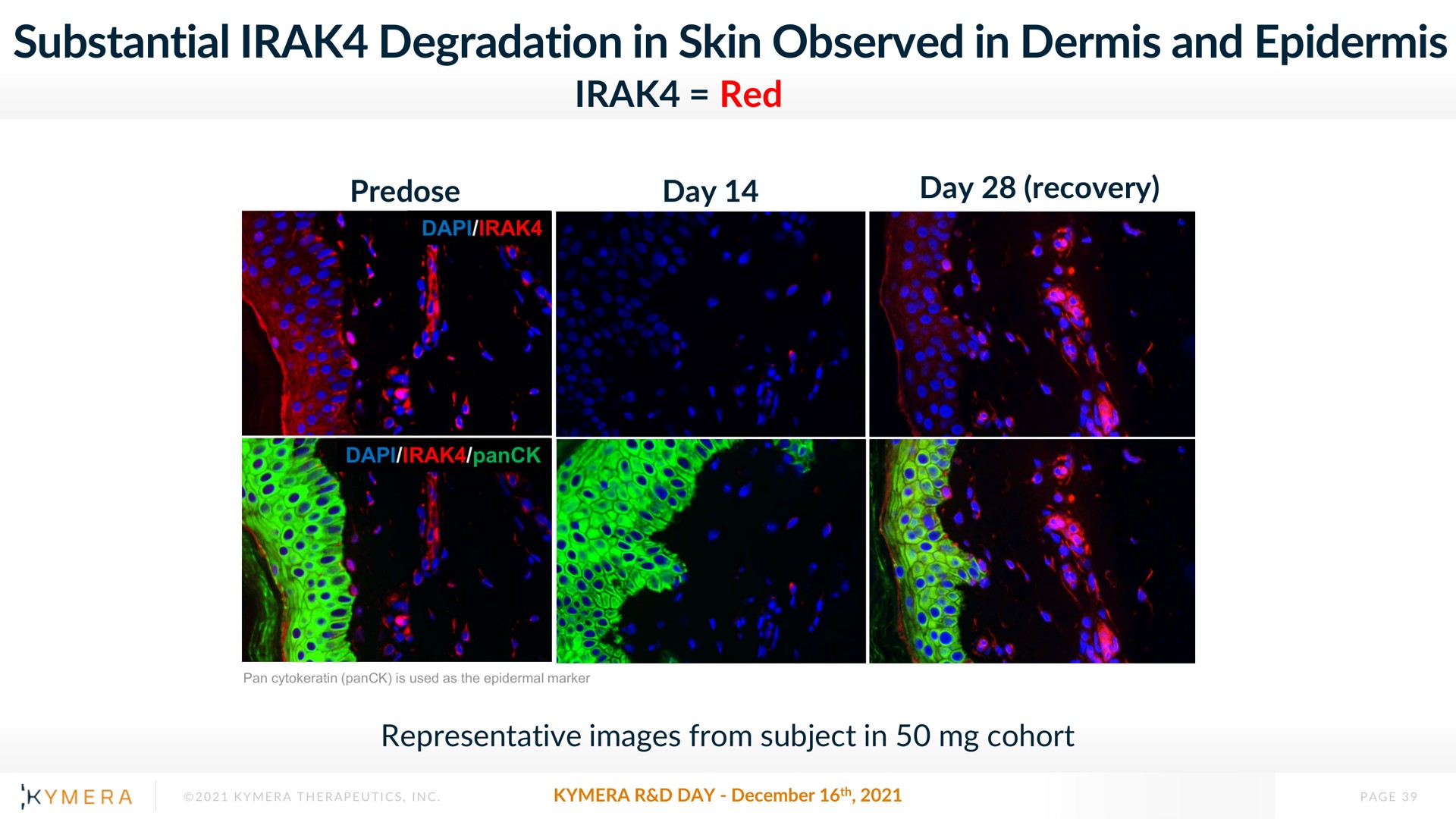 substantial degradation in skin observed in dermis and epidermis red | Kymera