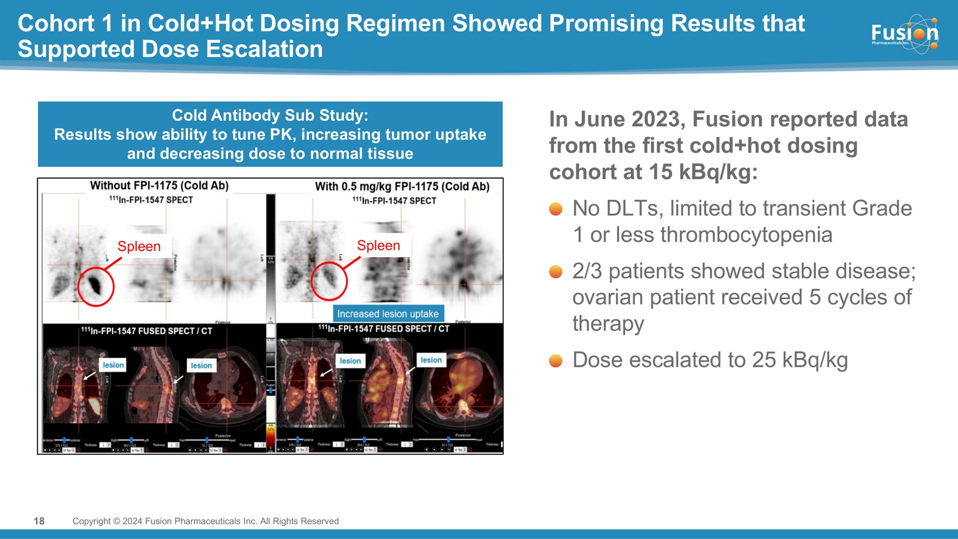 cohort in cold hot dosing regimen showed promising results that supported dose in june fusion reported data from the first cold hot dosing cohort at no limited to transient grade or less thrombocytopenia patients showed stable disease ovarian patient received cycles of therapy dose escalated to | Fusion Pharmaceuticals