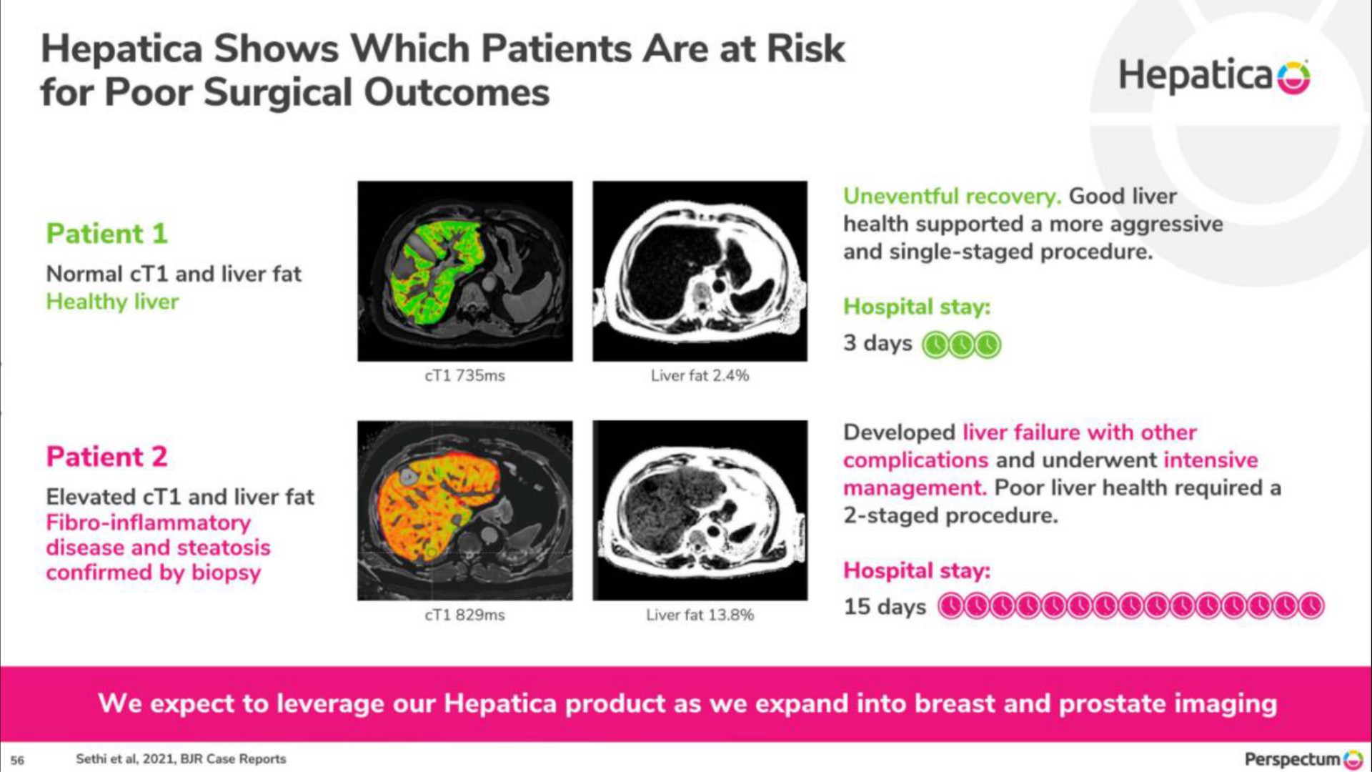 hepatica shows which patients are at risk for poor surgical outcomes | Perspectum