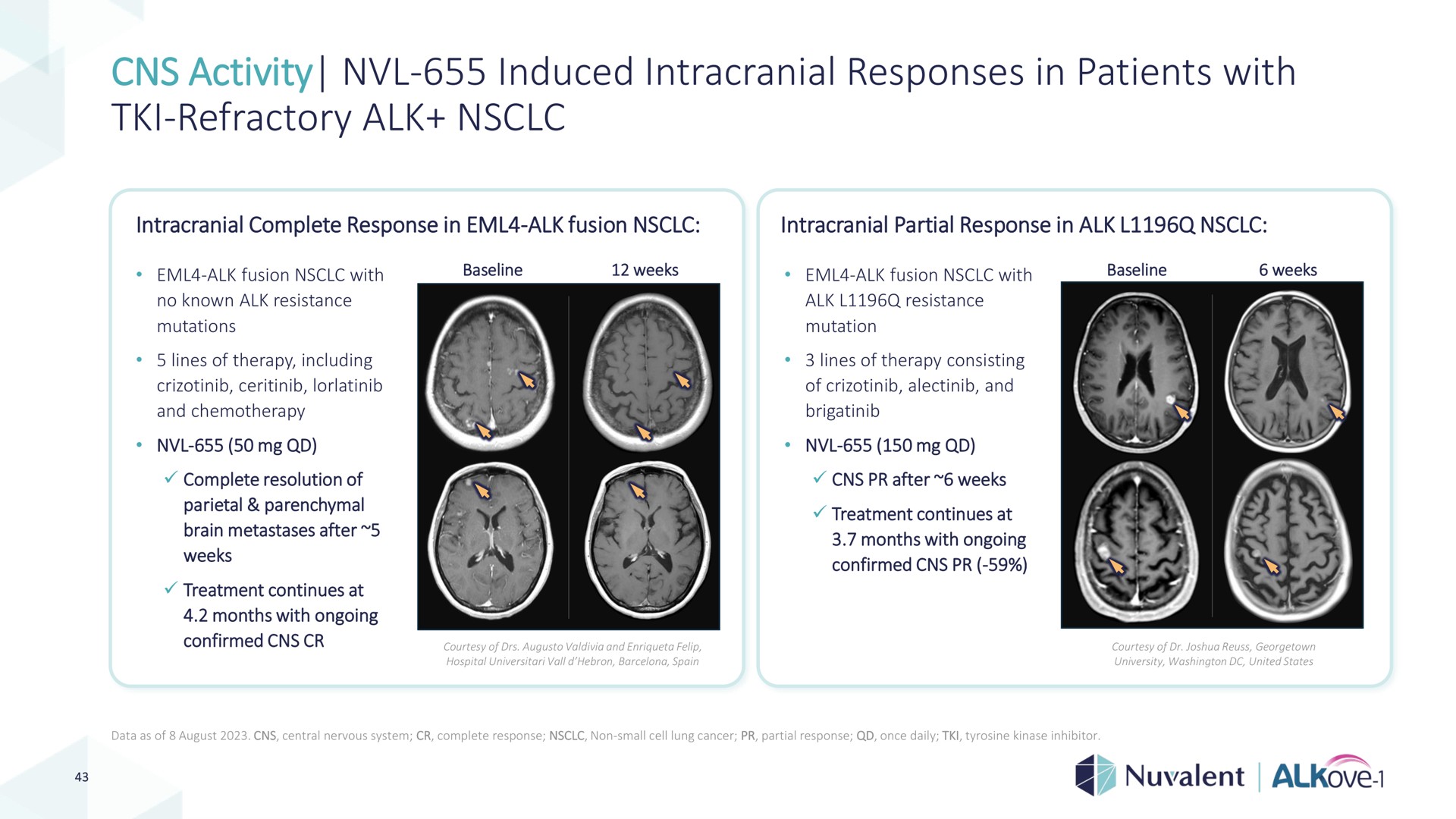 activity induced intracranial responses in patients with refractory alk | Nuvalent