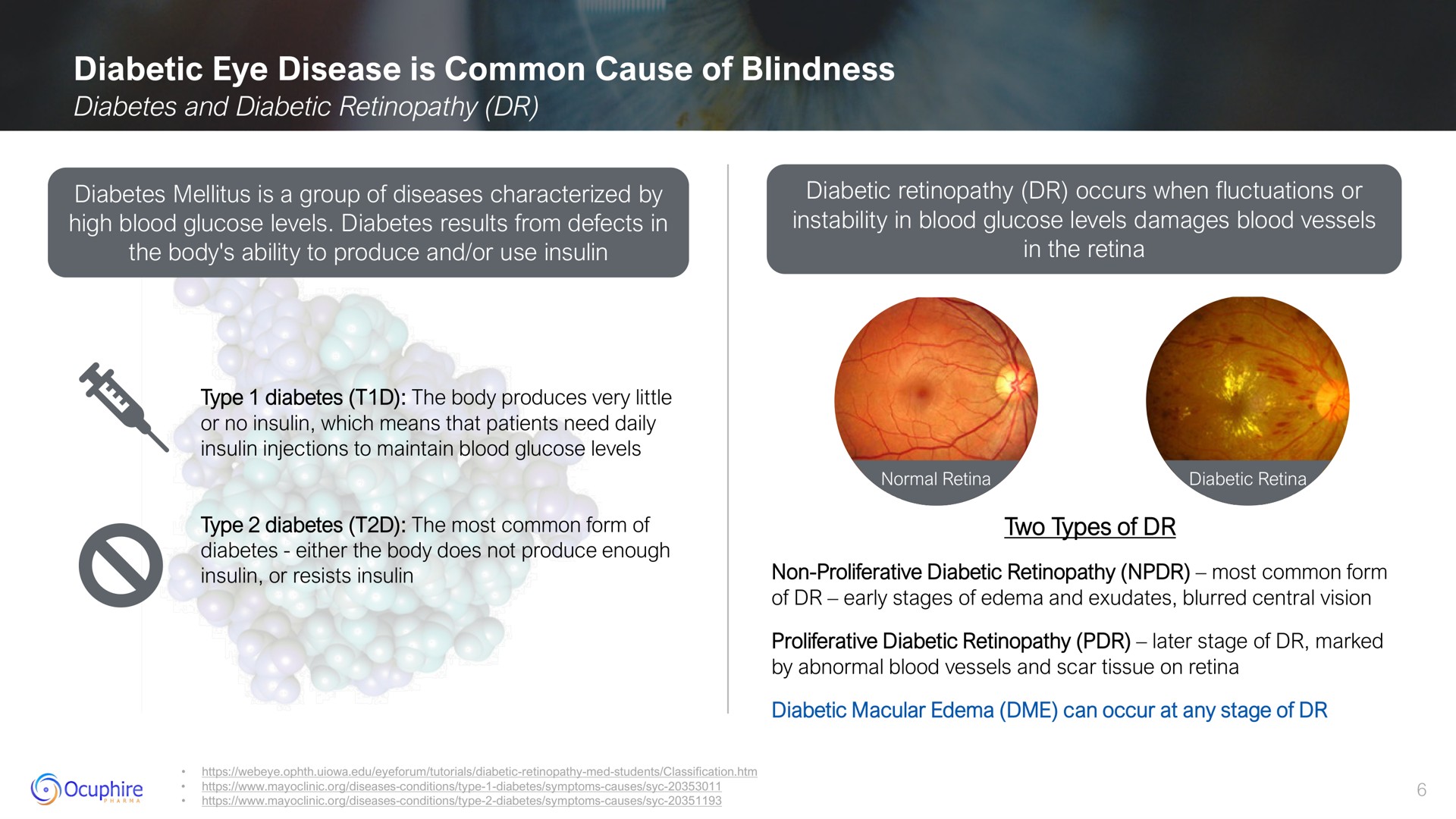 diabetic eye disease is common cause of blindness diabetes a group diseases characterized by occurs when fluctuations or | Ocuphire Pharma