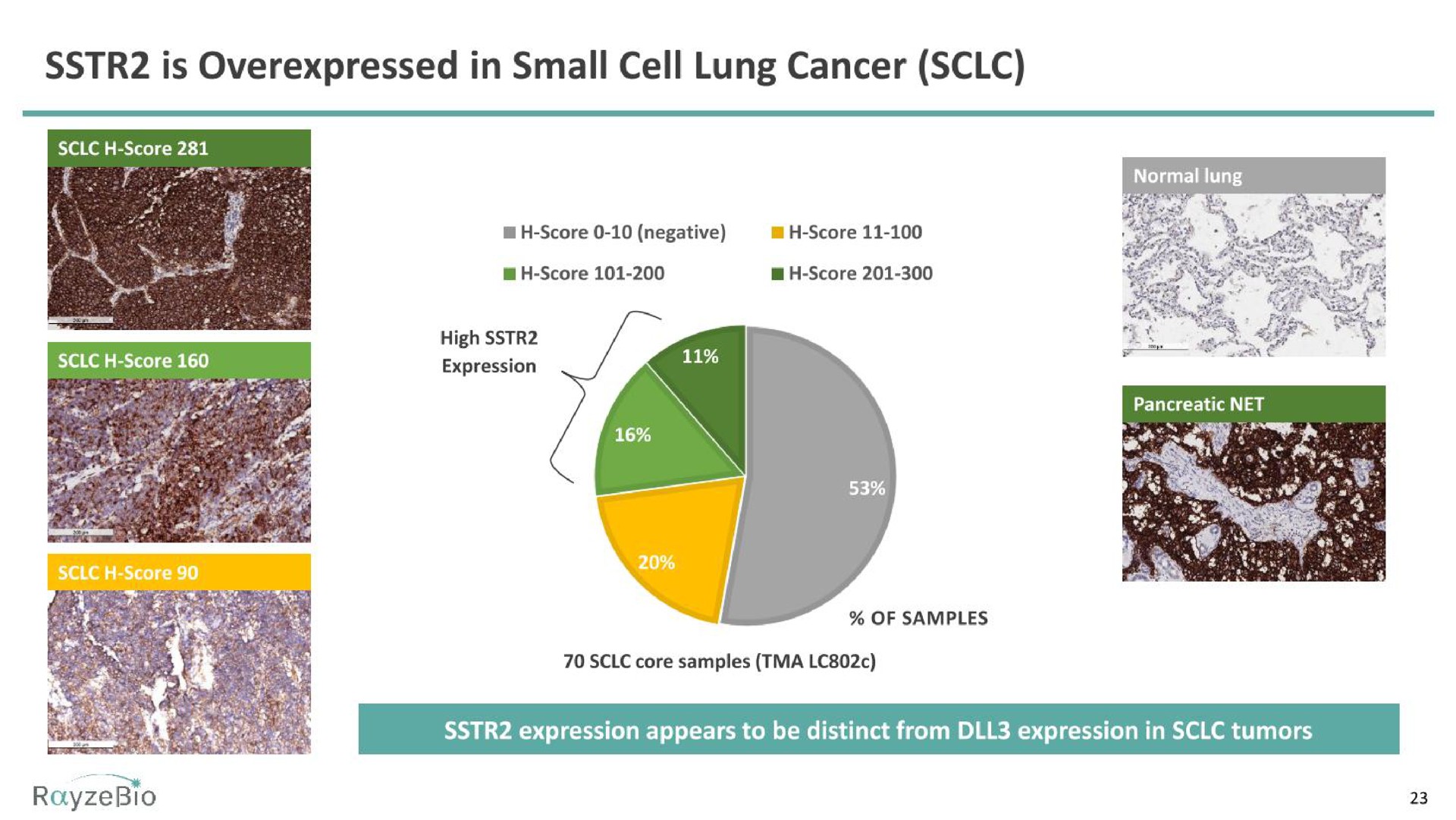 is in small cell lung cancer | RayzeBio