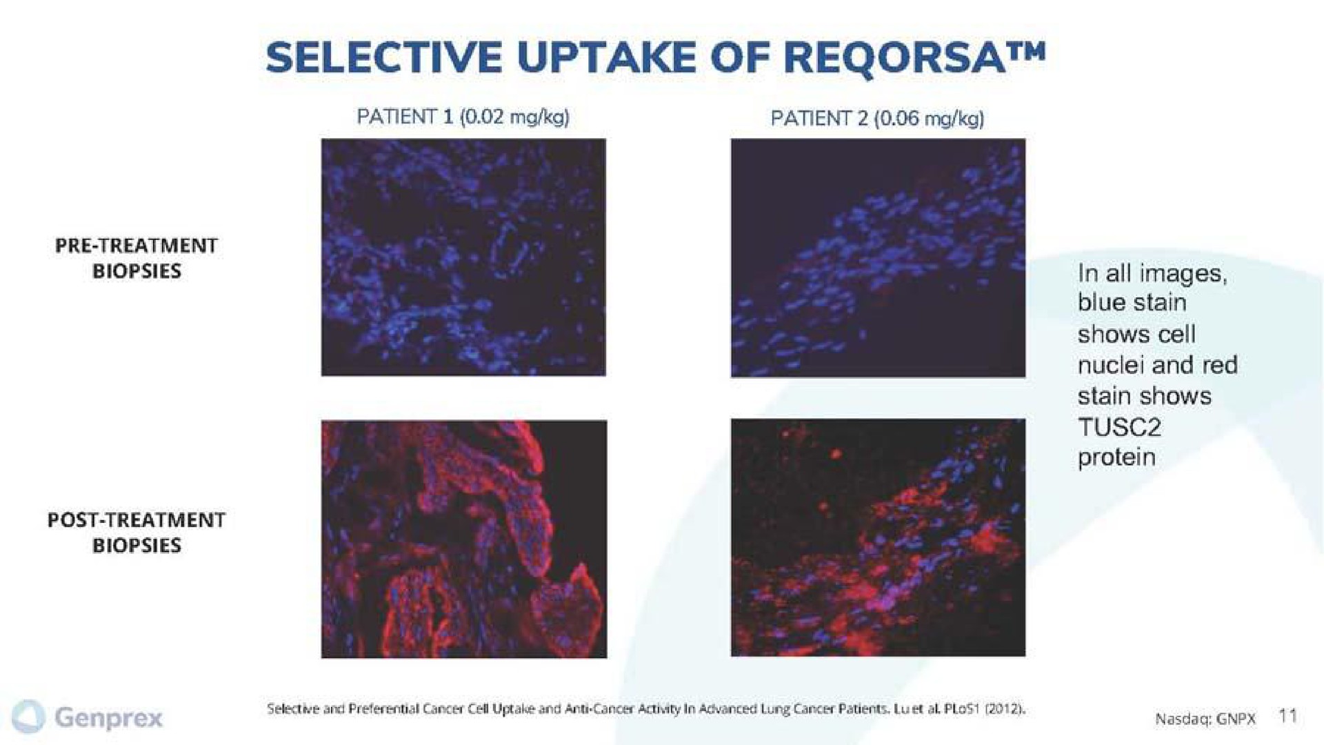 selective uptake of | Genprex