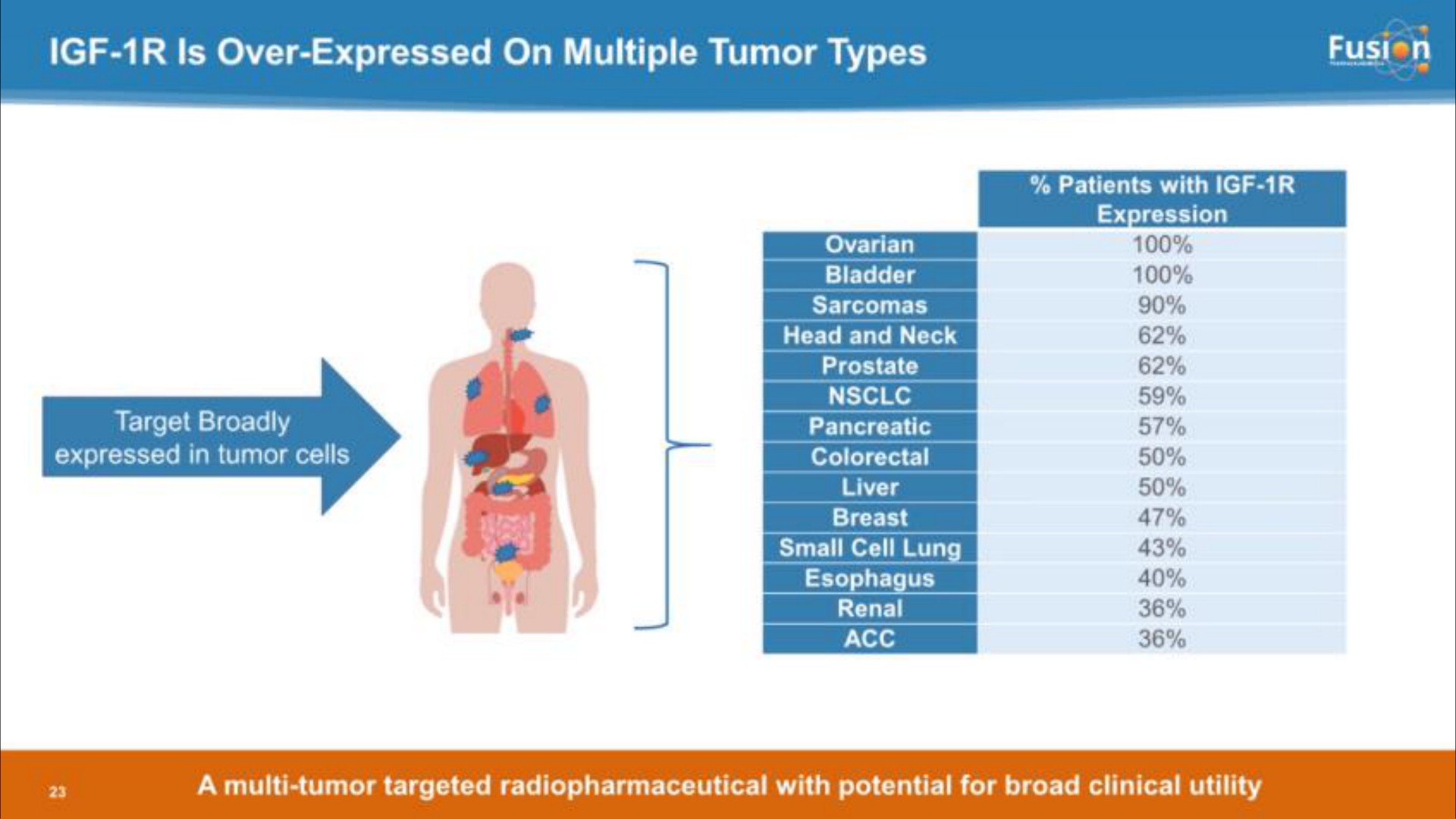 is over expressed on multiple tumor types | Fusion Pharmaceuticals