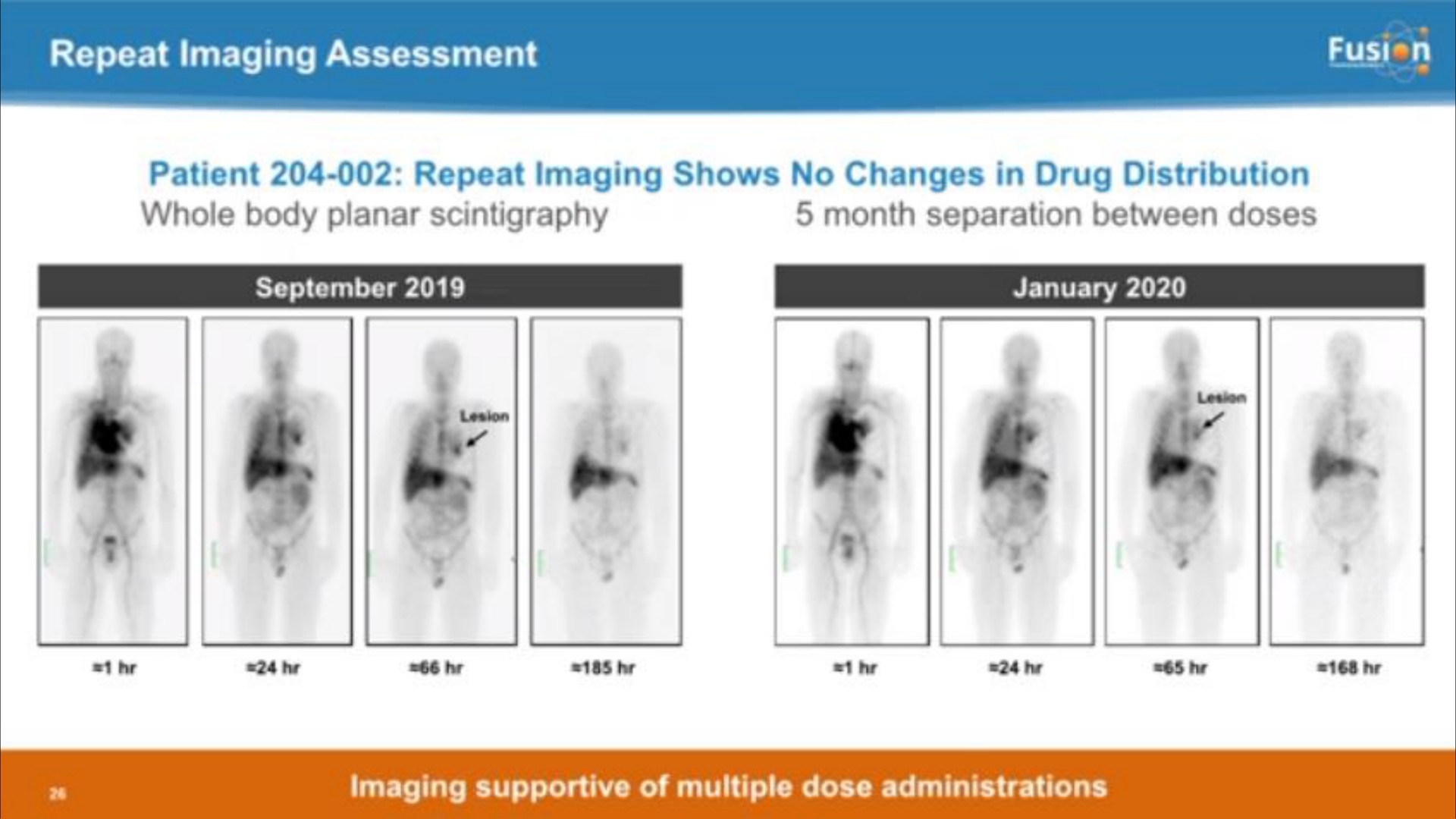 repeat imaging assessment | Fusion Pharmaceuticals