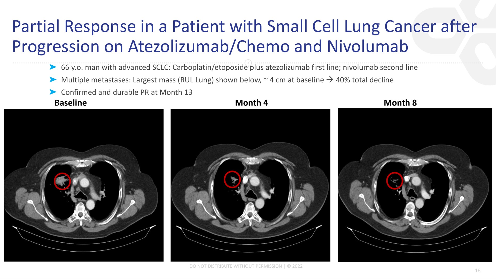 partial response in a patient with small cell lung cancer after progression on and | Compass Therapeutics