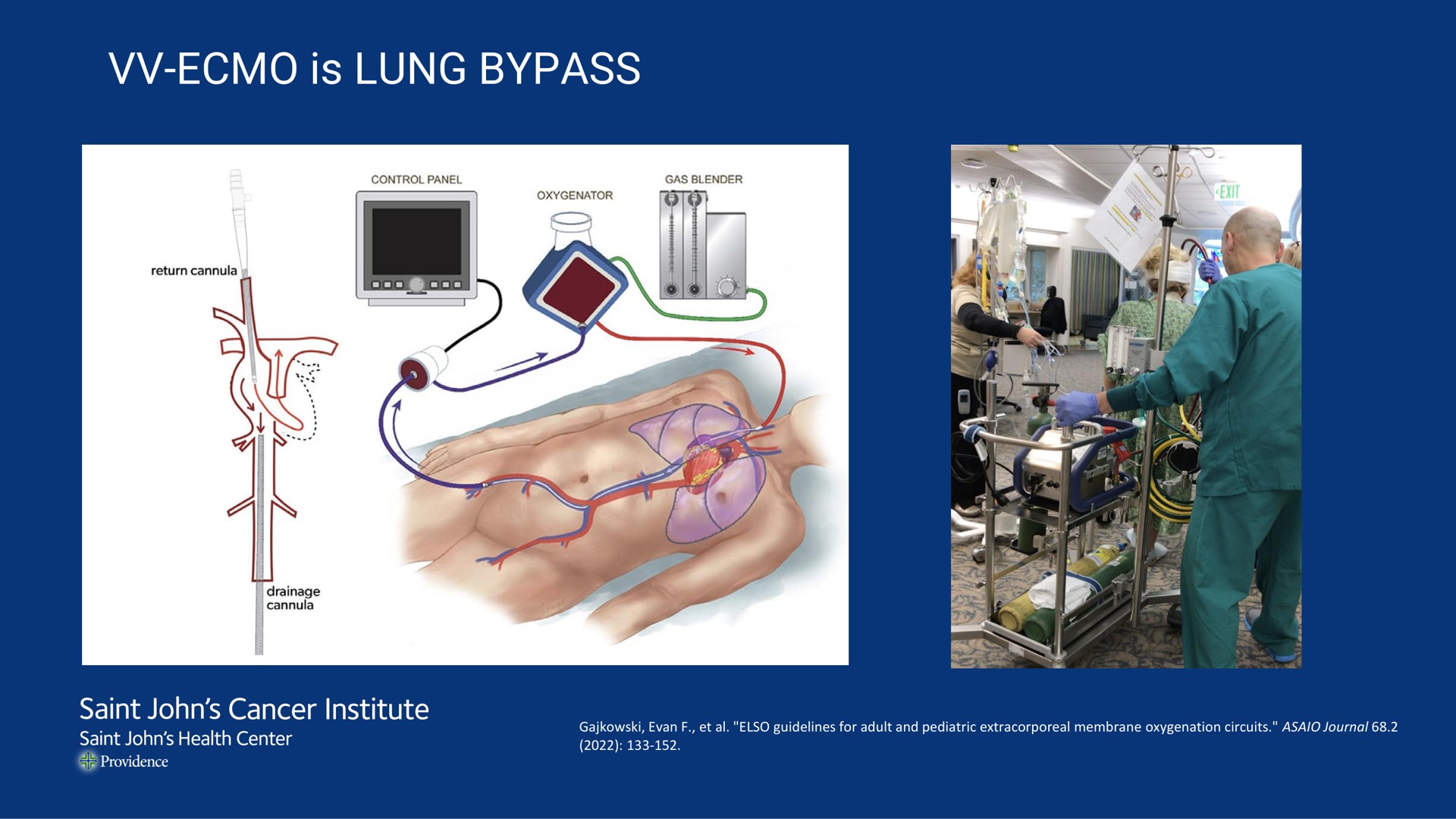 is lung bypass | Mink Therapeutics