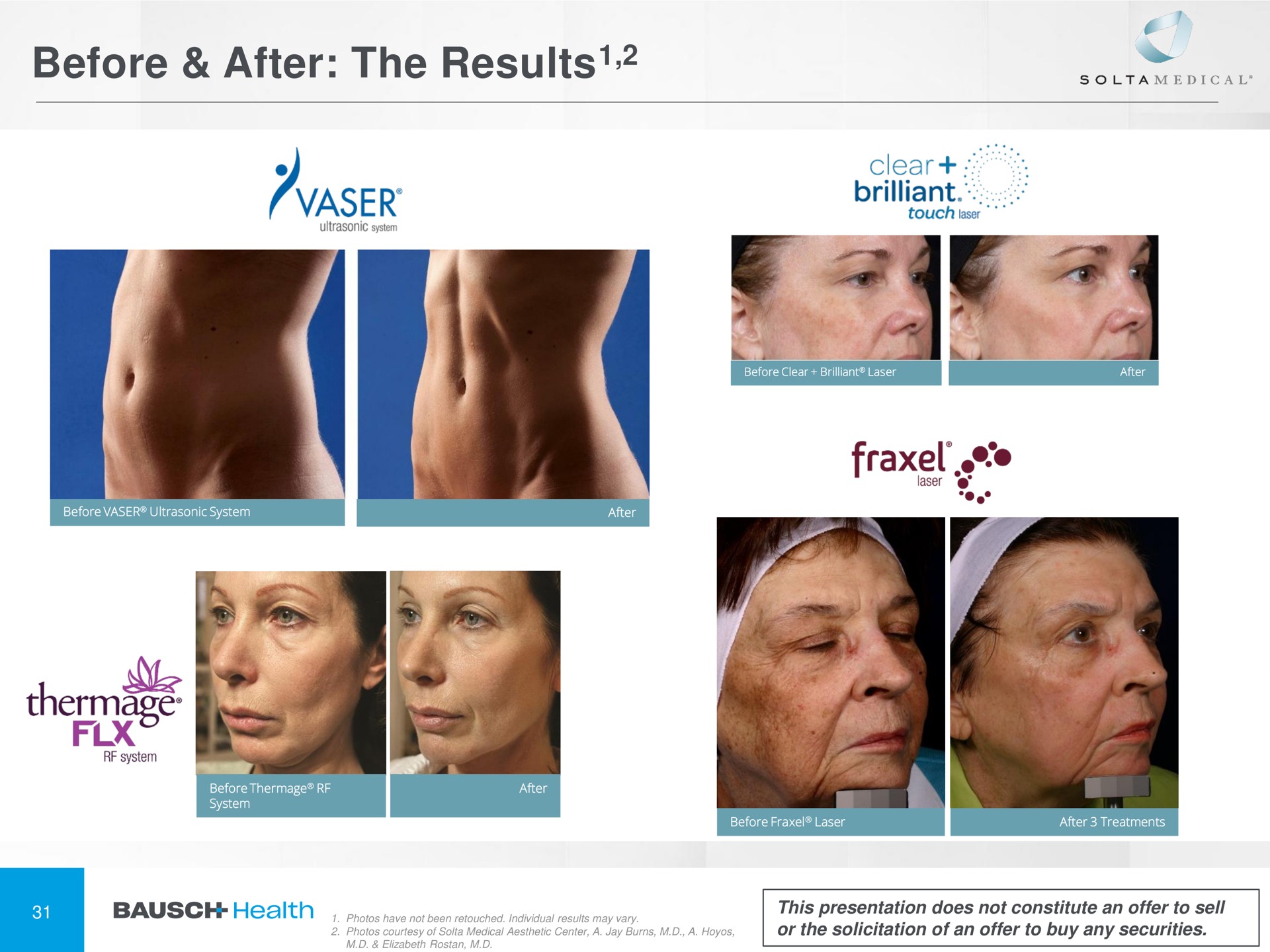 before after the results results | Bausch Health Companies