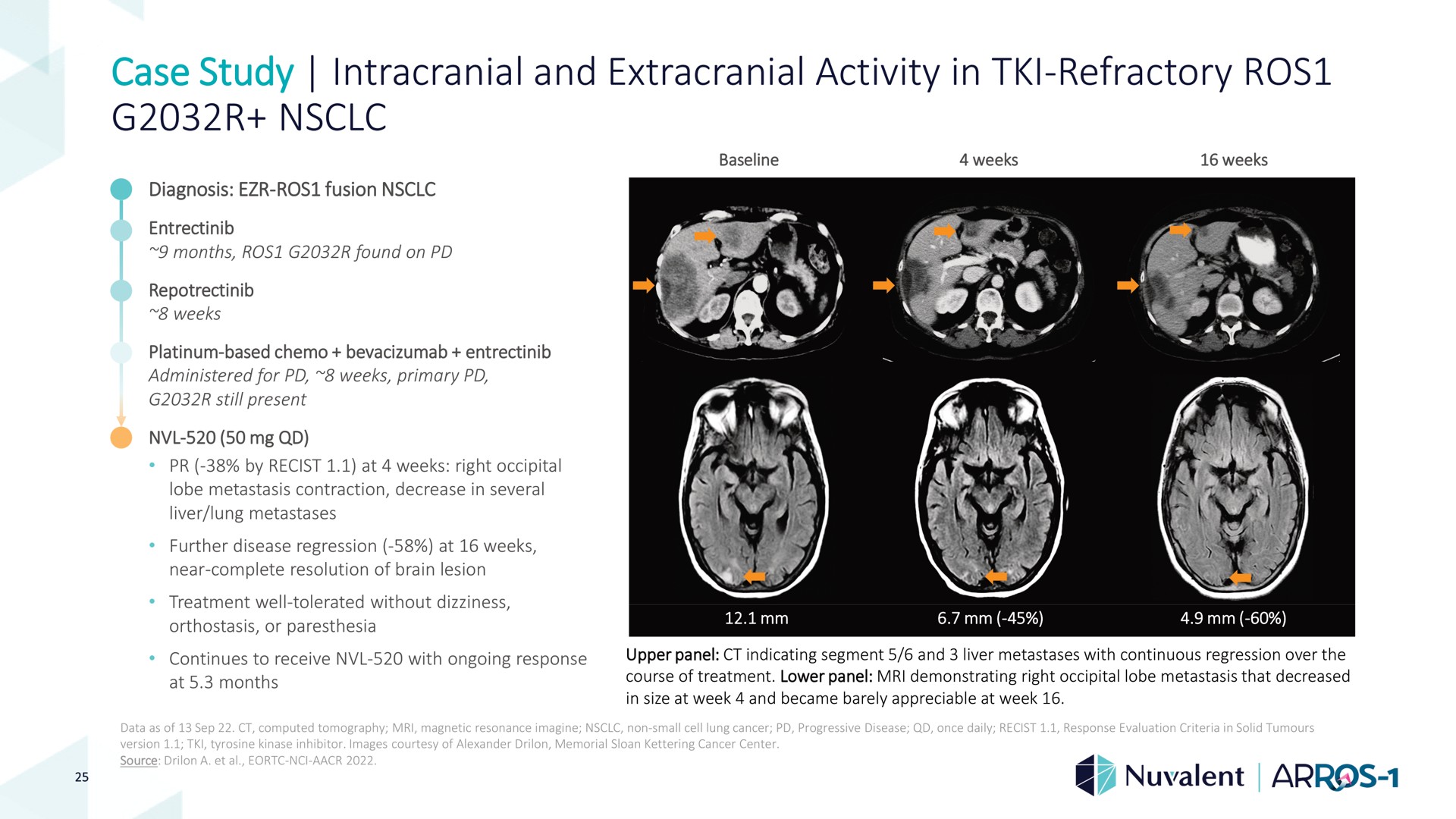 case study intracranial and extracranial activity in refractory refractory | Nuvalent
