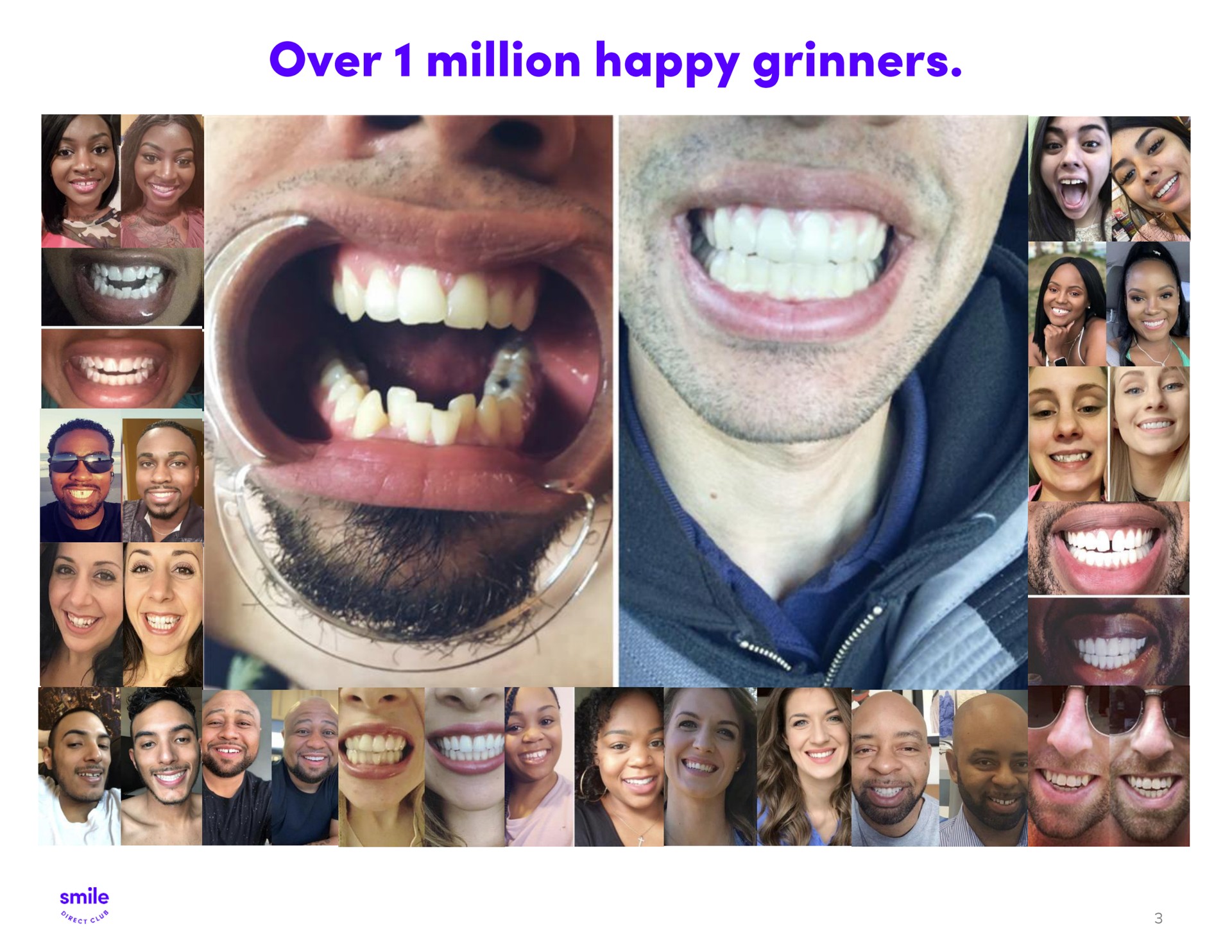 over million happy grinners | SmileDirectClub