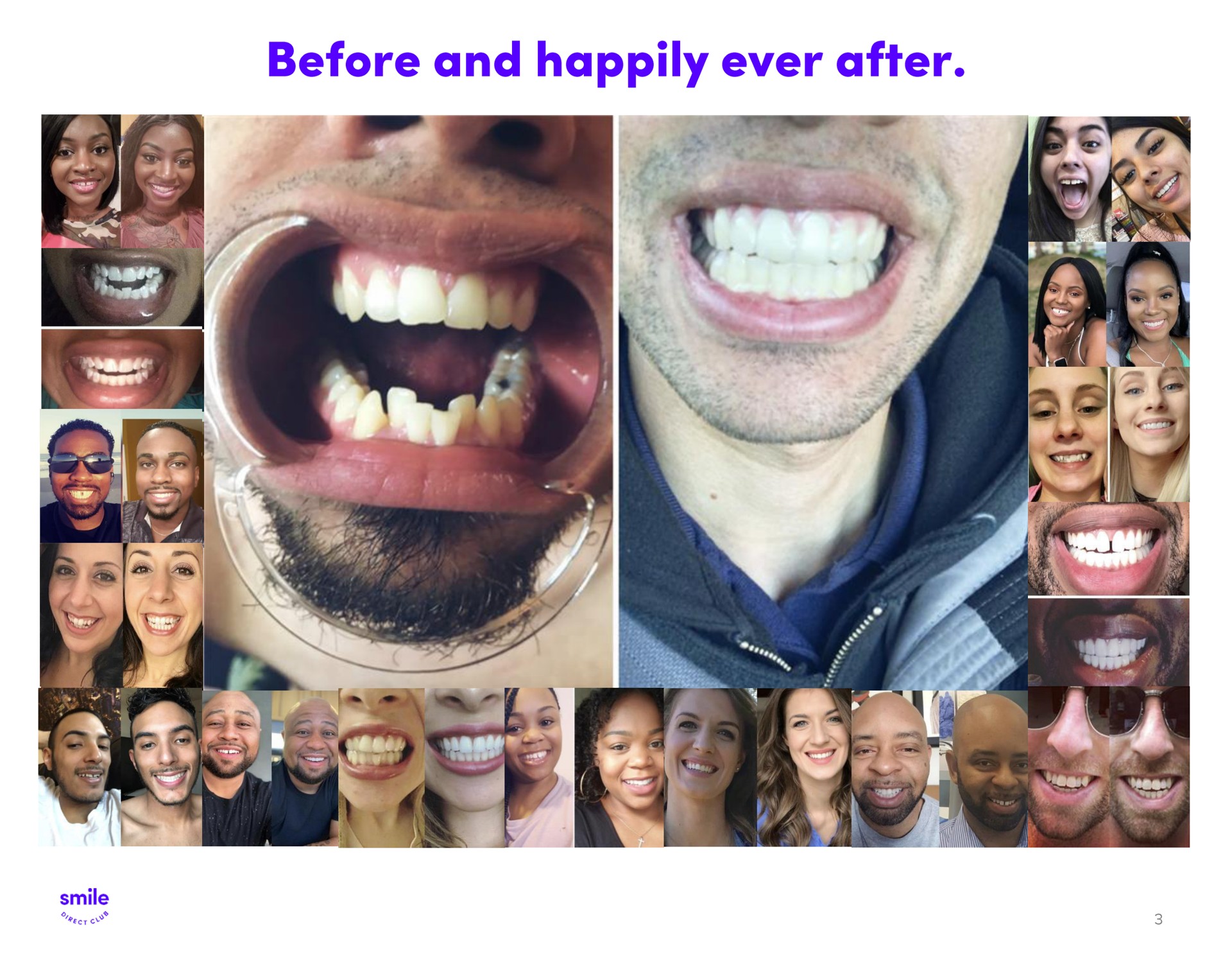 before and happily ever after | SmileDirectClub