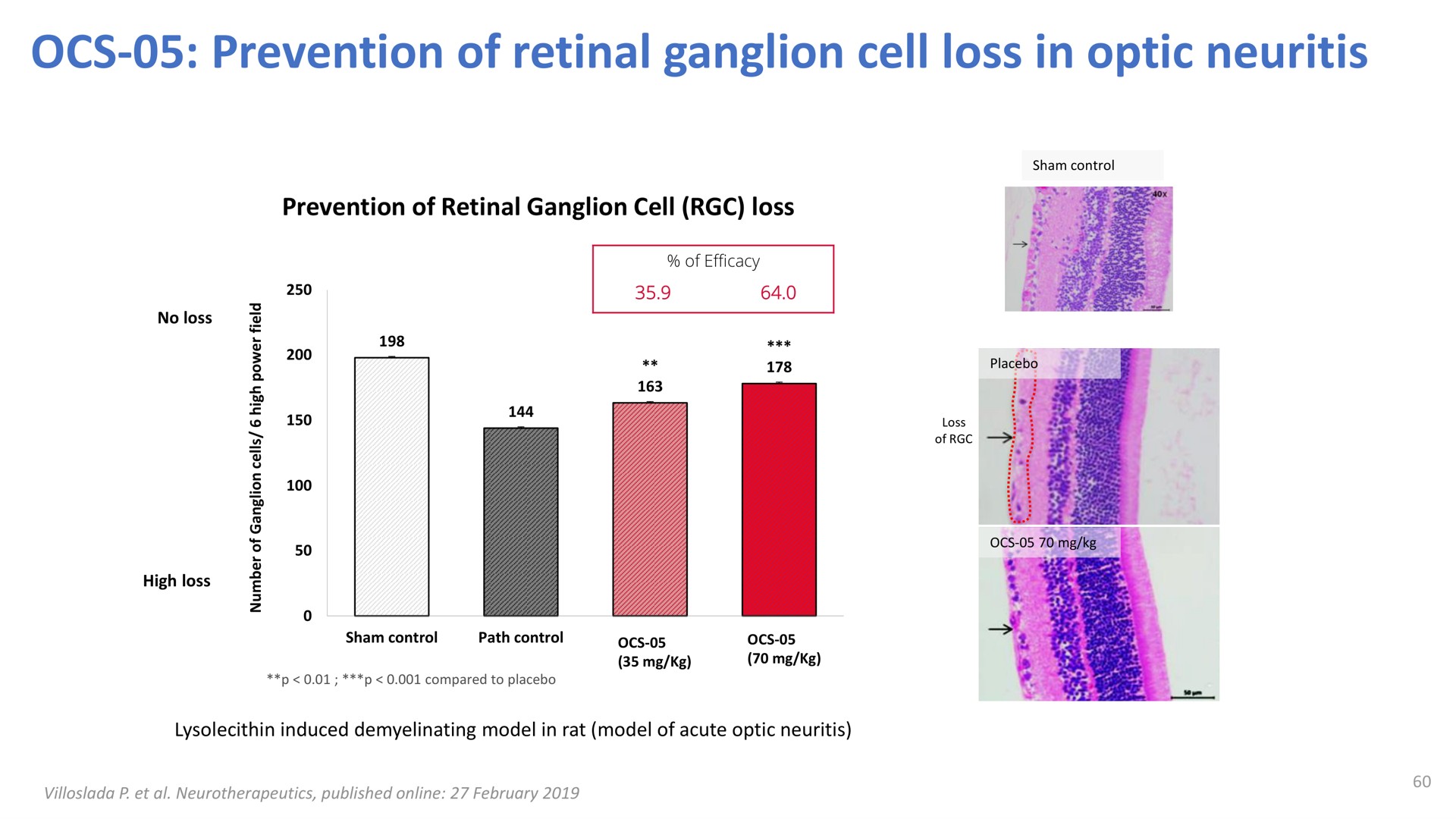 prevention of retinal ganglion cell loss in optic neuritis | Oculis