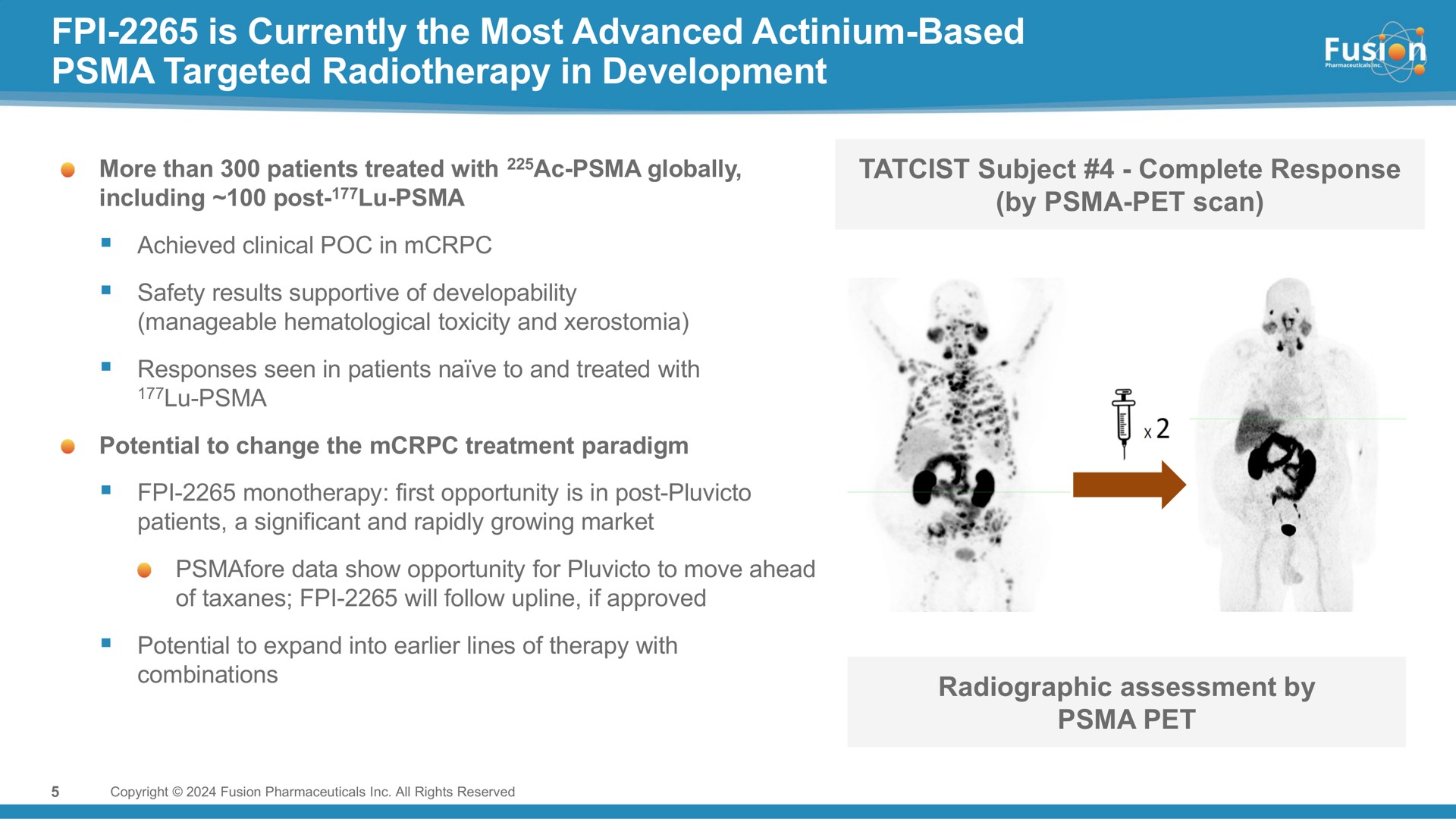 is currently the most advanced actinium based targeted radiotherapy in development | Fusion Pharmaceuticals