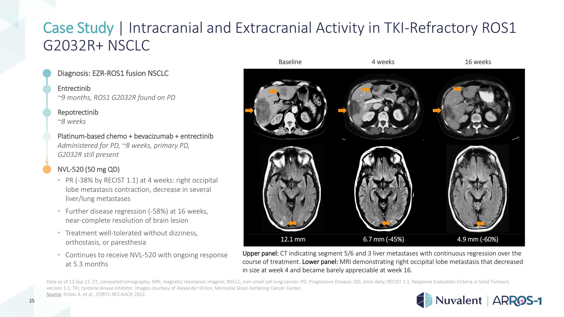 case study intracranial and extracranial activity in refractory ase refractory | Nuvalent