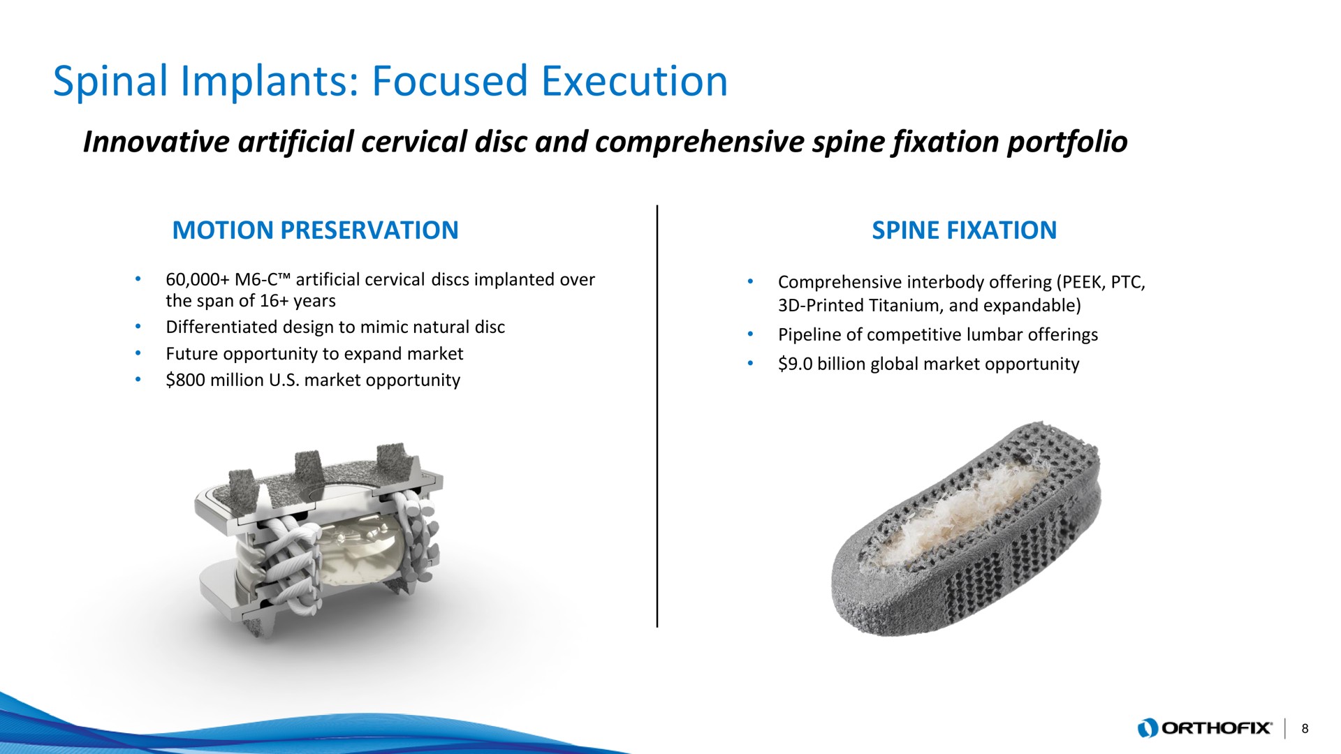 spinal implants focused execution | Orthofix