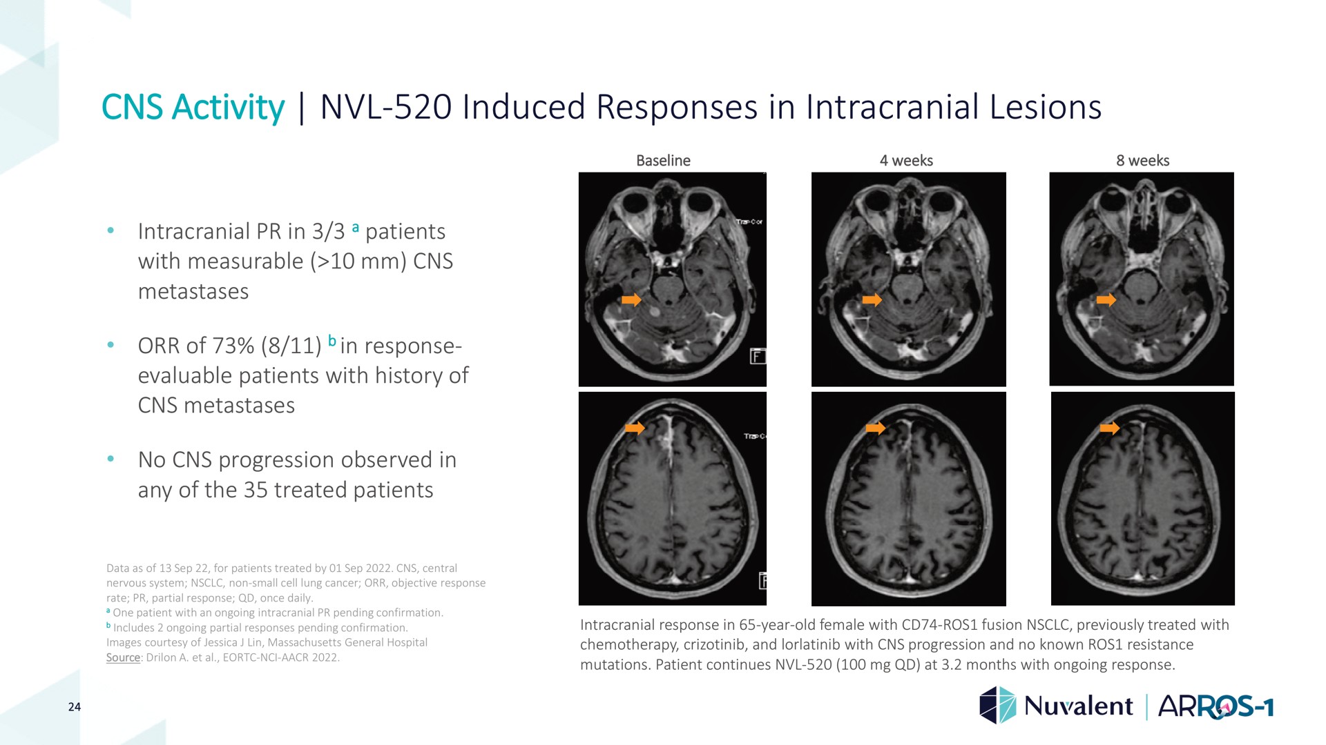 activity induced responses in intracranial lesions | Nuvalent