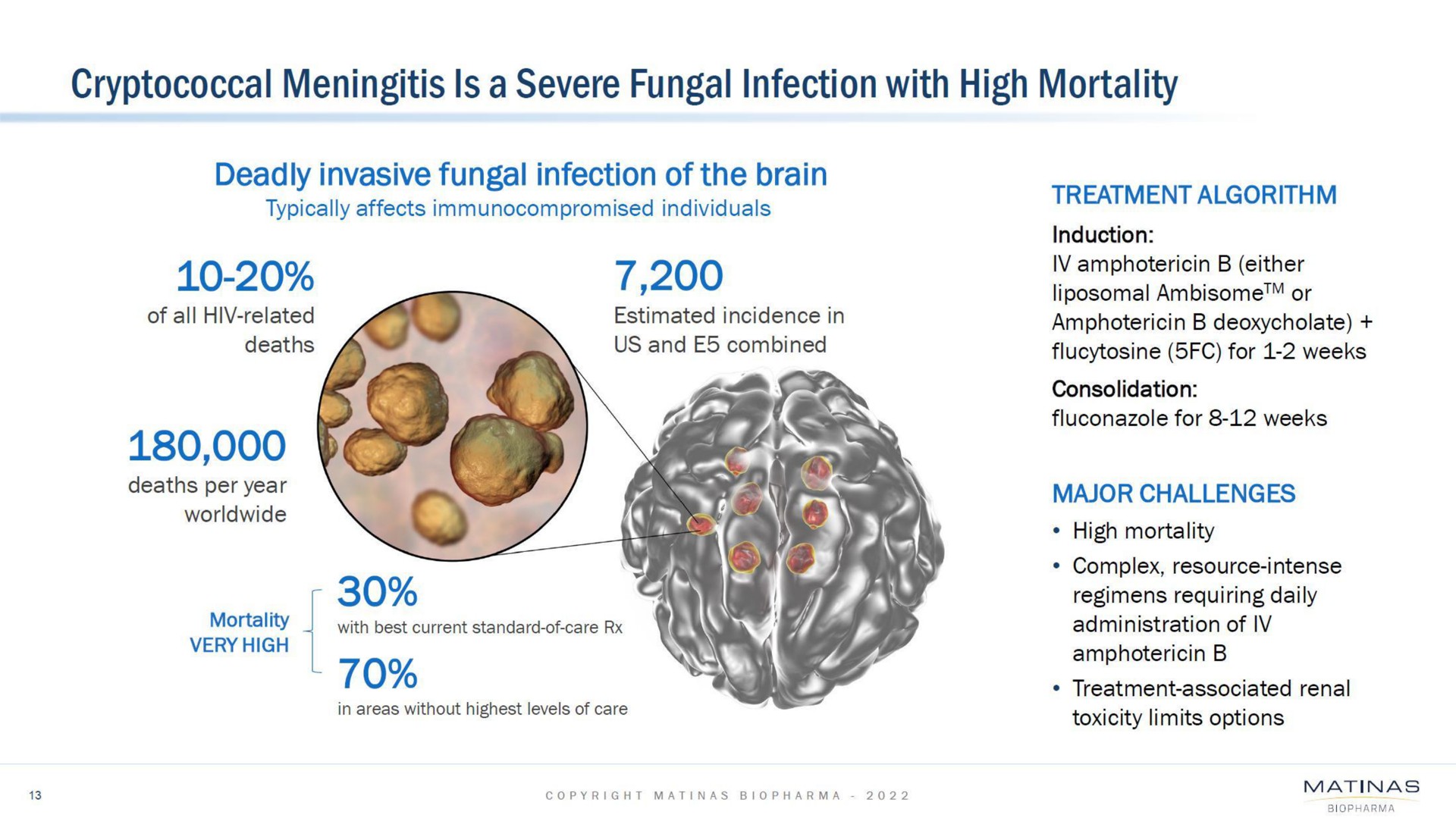 meningitis is a severe fungal infection with high mortality | Matinas BioPharma