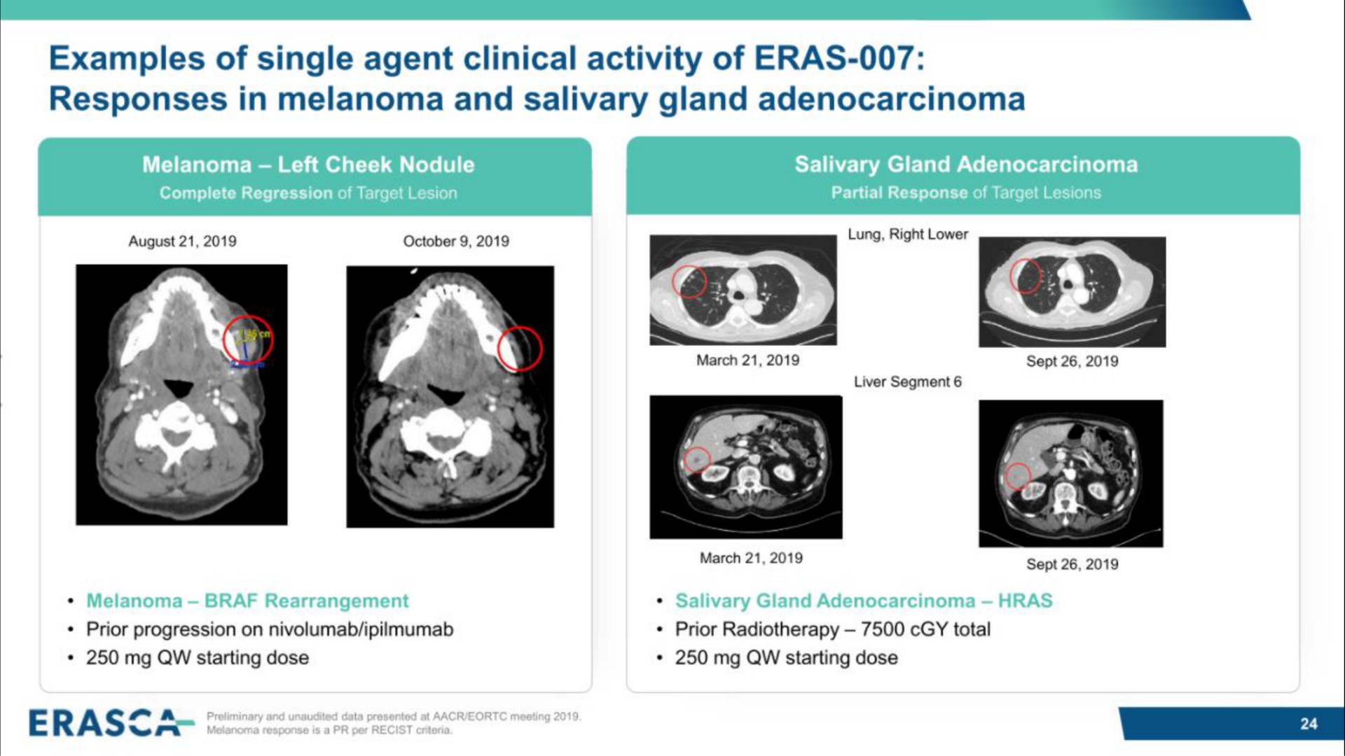 examples of single agent clinical activity of eras responses in melanoma and salivary gland adenocarcinoma pease | Erasca