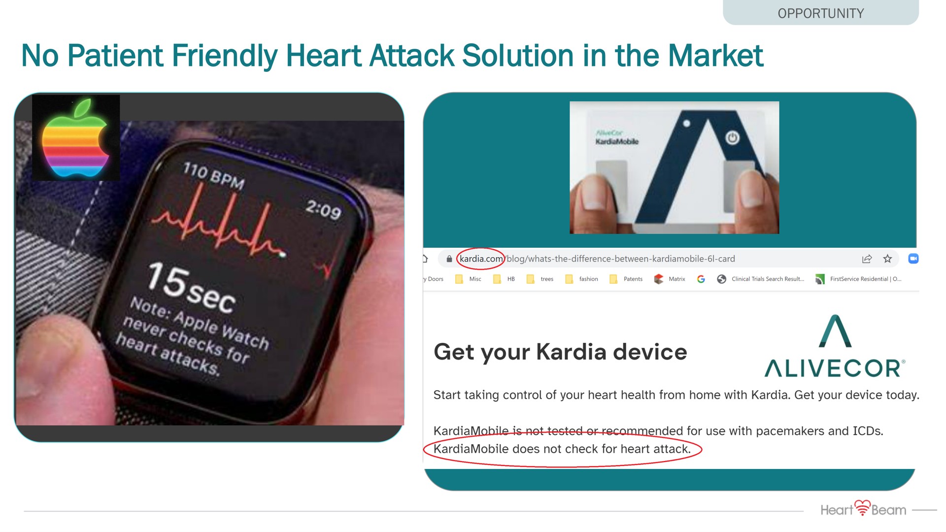 no patient friendly heart attack solution in the market | HeartBeam