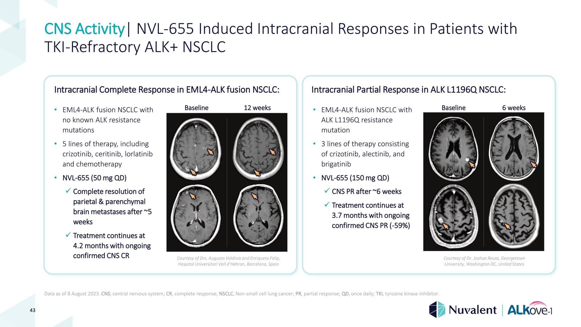 activity induced intracranial responses in patients with refractory alk refractory i | Nuvalent