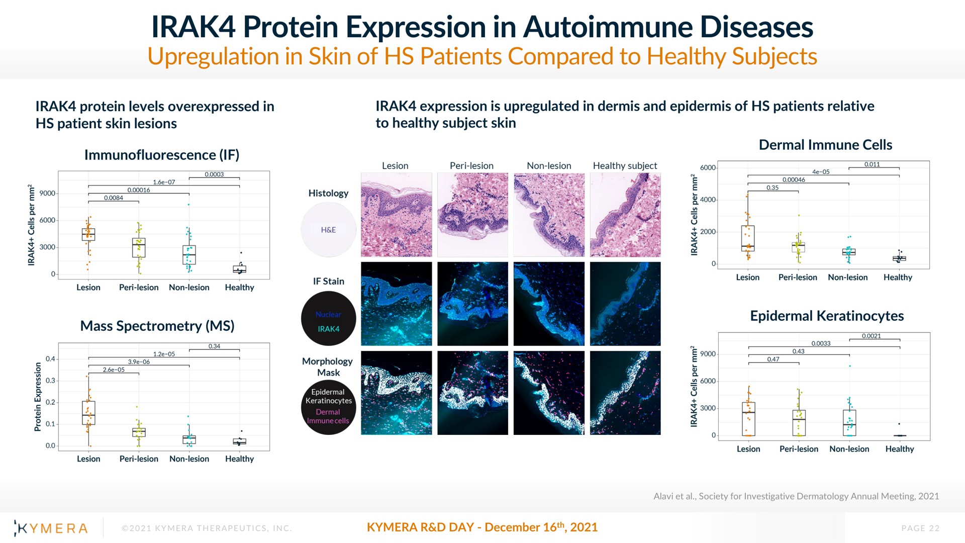 protein expression in diseases | Kymera
